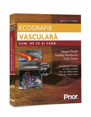 Ecografie vasculara. Cum, de ce si cand