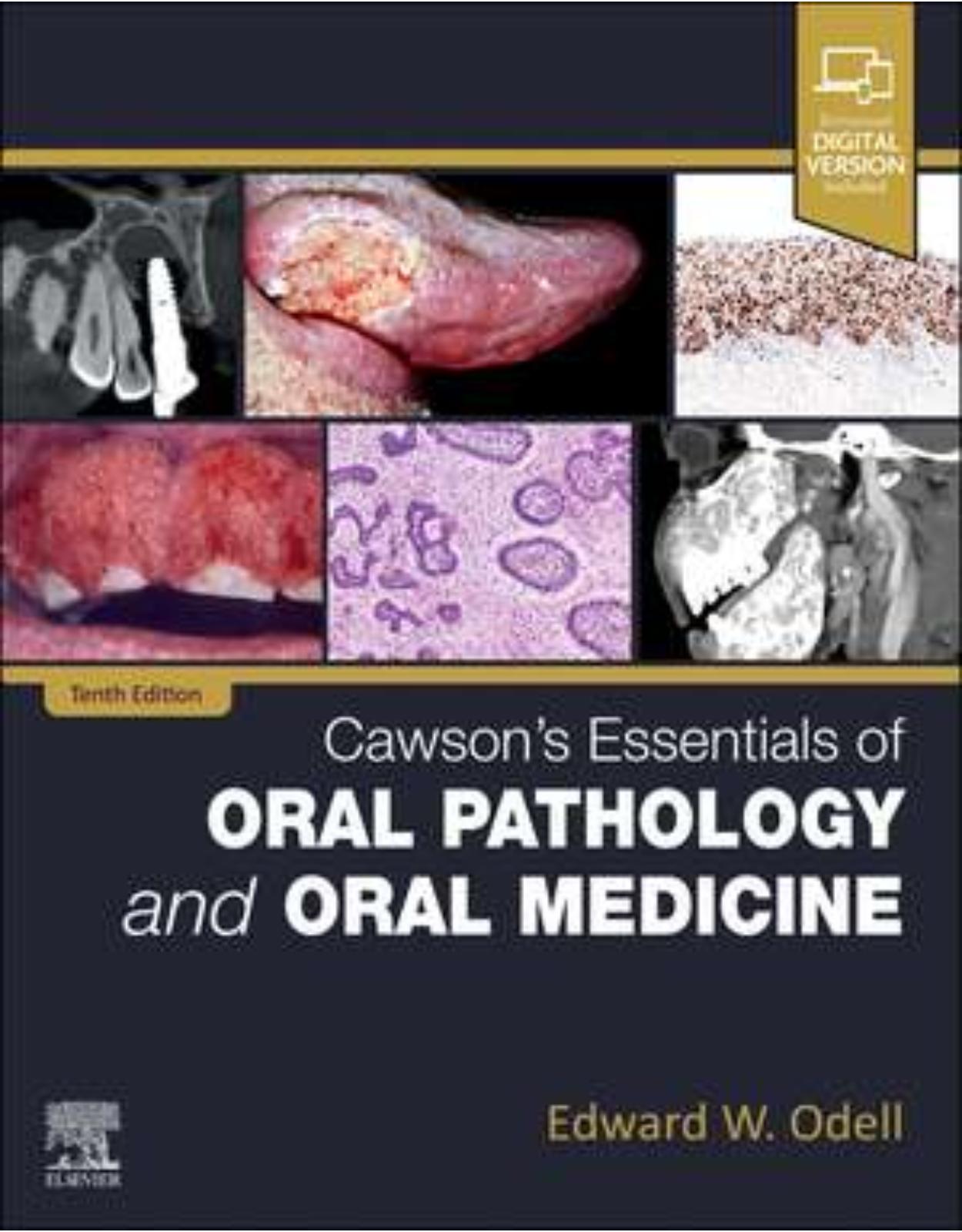 Cawson’s Essentials of Oral Pathology and Oral Medicine