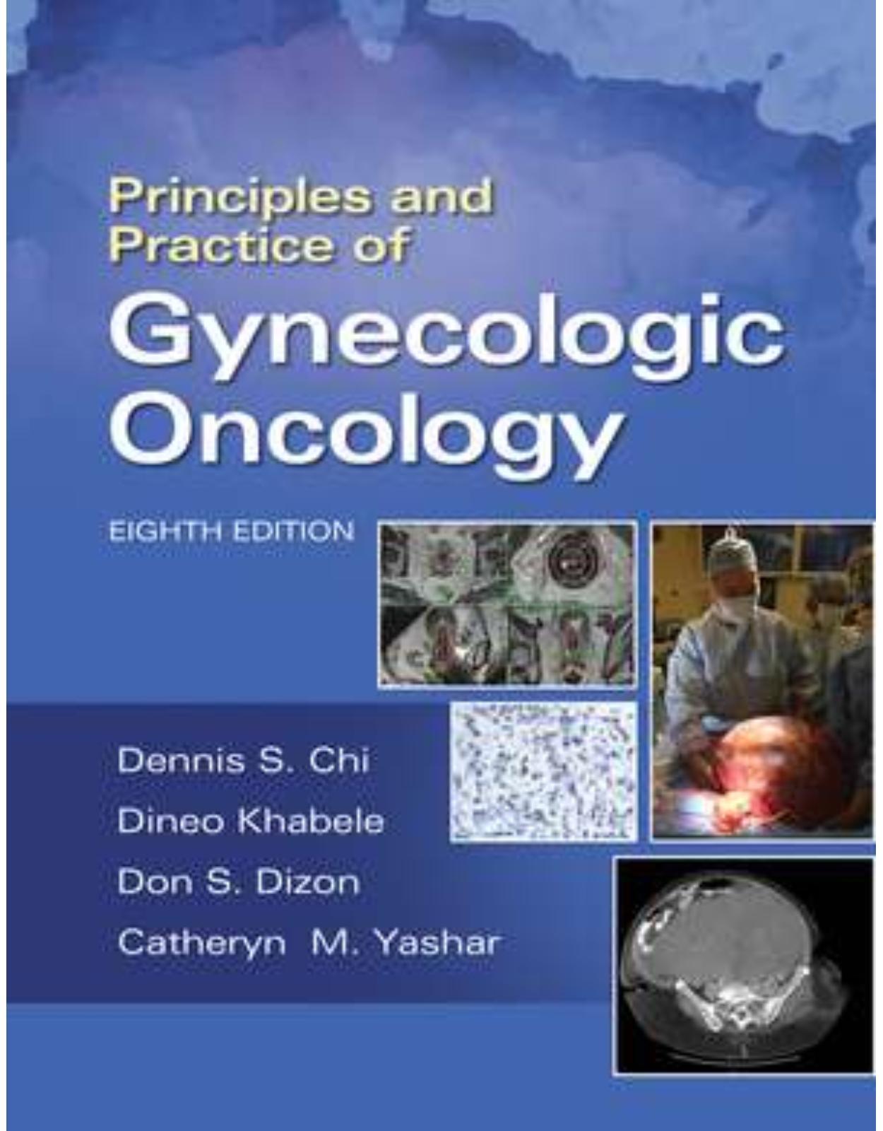 Principles and Practice of Gynecologic Oncology