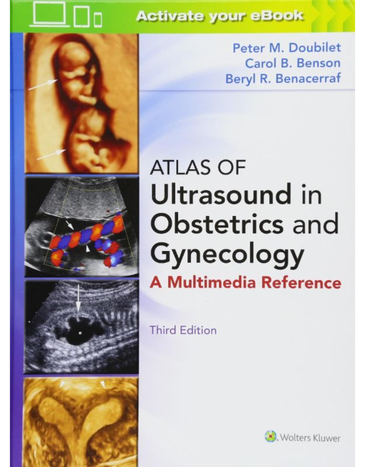 Atlas of Ultrasound in Obstetrics and Gynecology