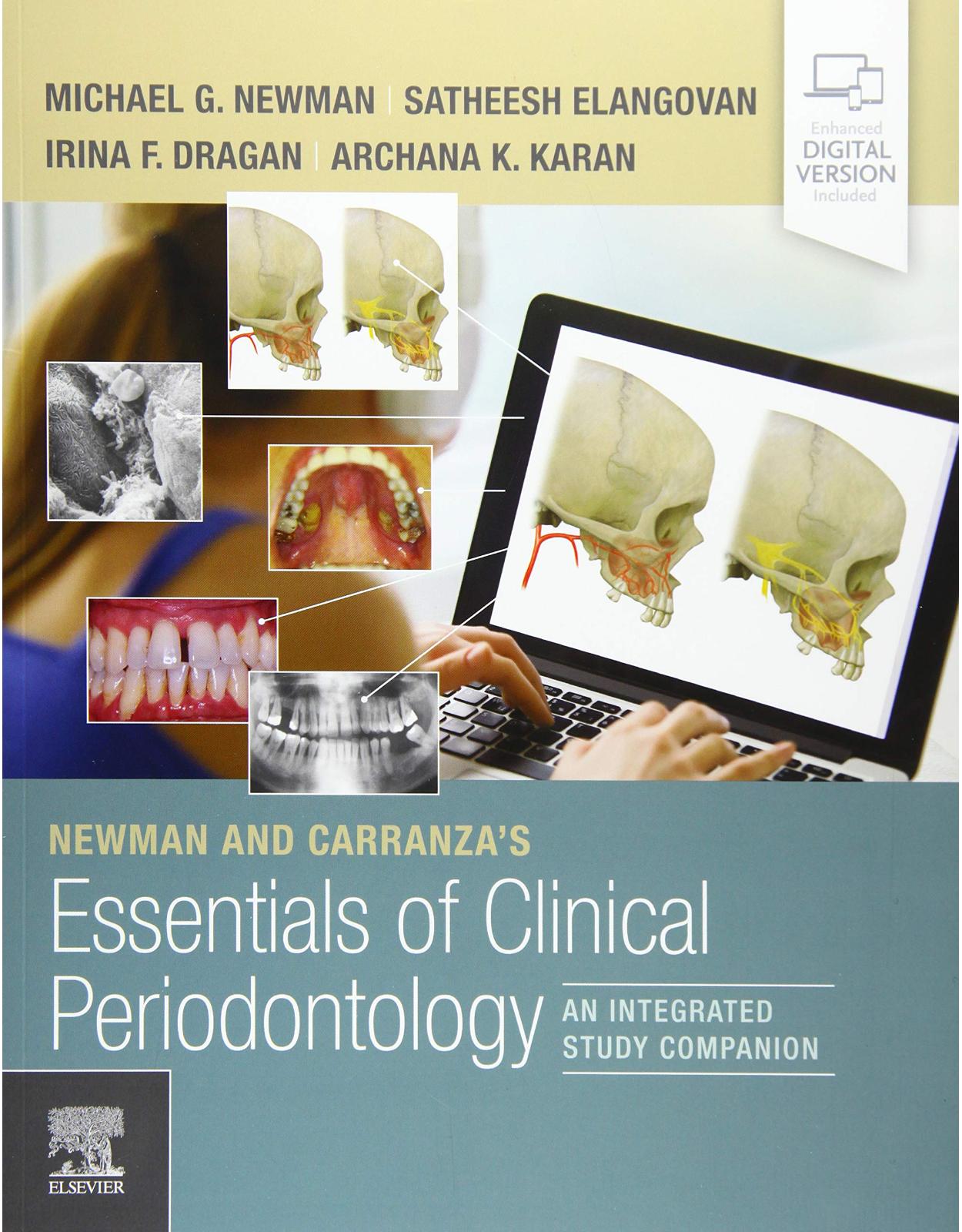 Newman and Carranza's Essentials of Clinical Periodontology: An Integrated Study Companion 