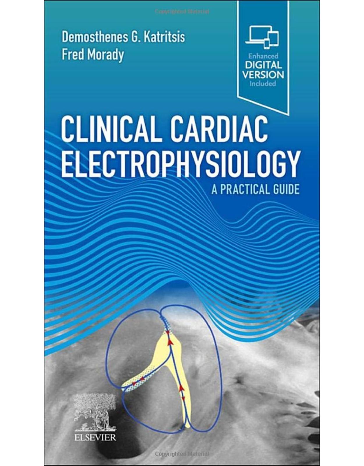 Clinical Cardiac Electrophysiology: A Practical Guide