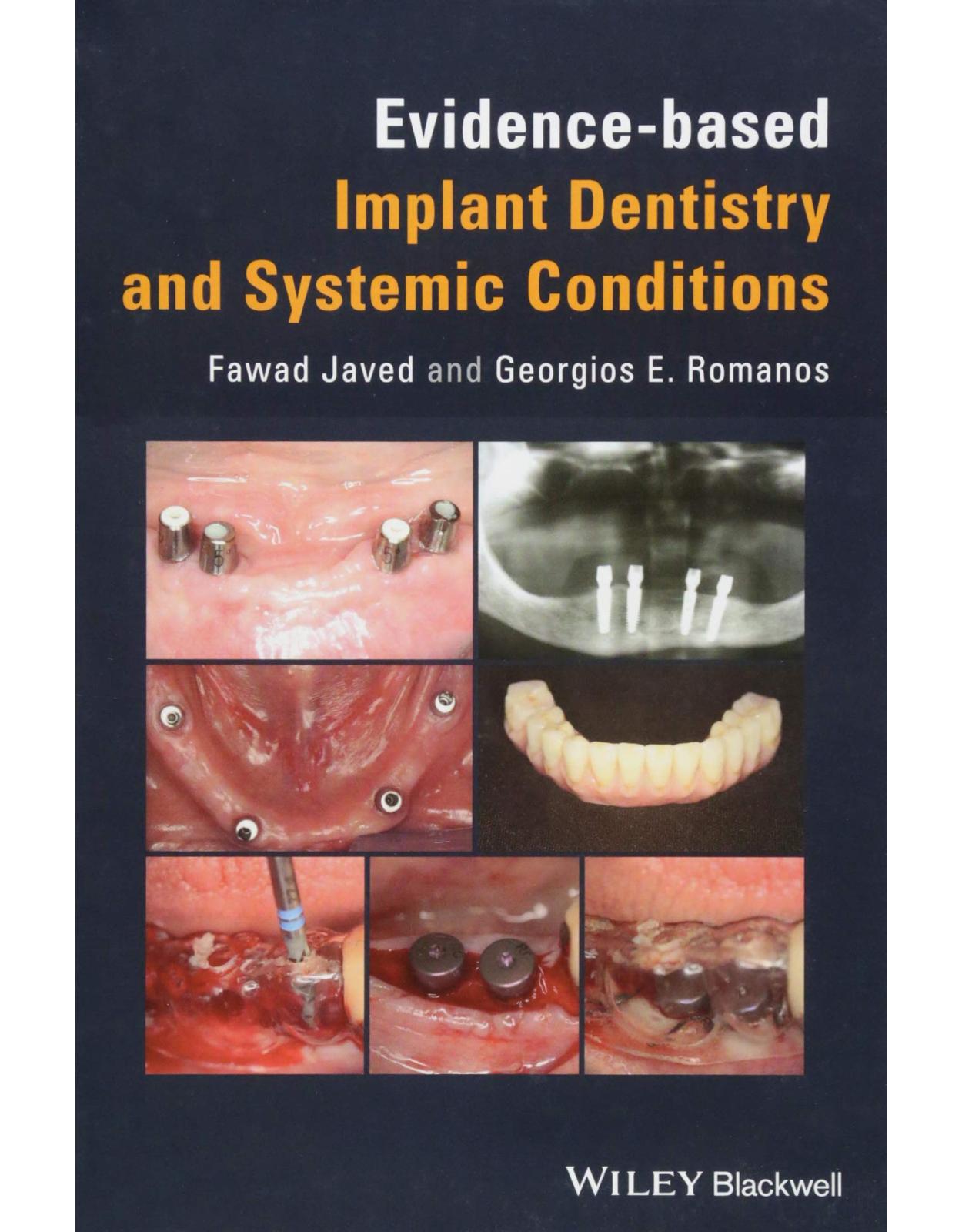 Evidencebased Implant Dentistry and Systemic Conditions