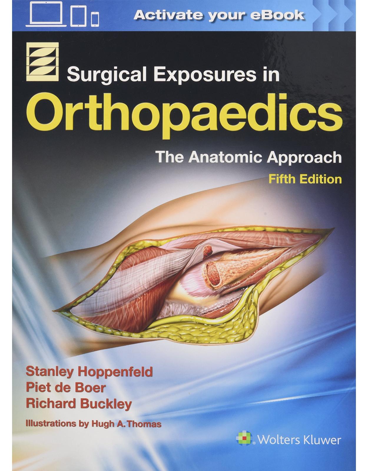 Surgical Exposures in Orthopaedics: the Anatomic Approach