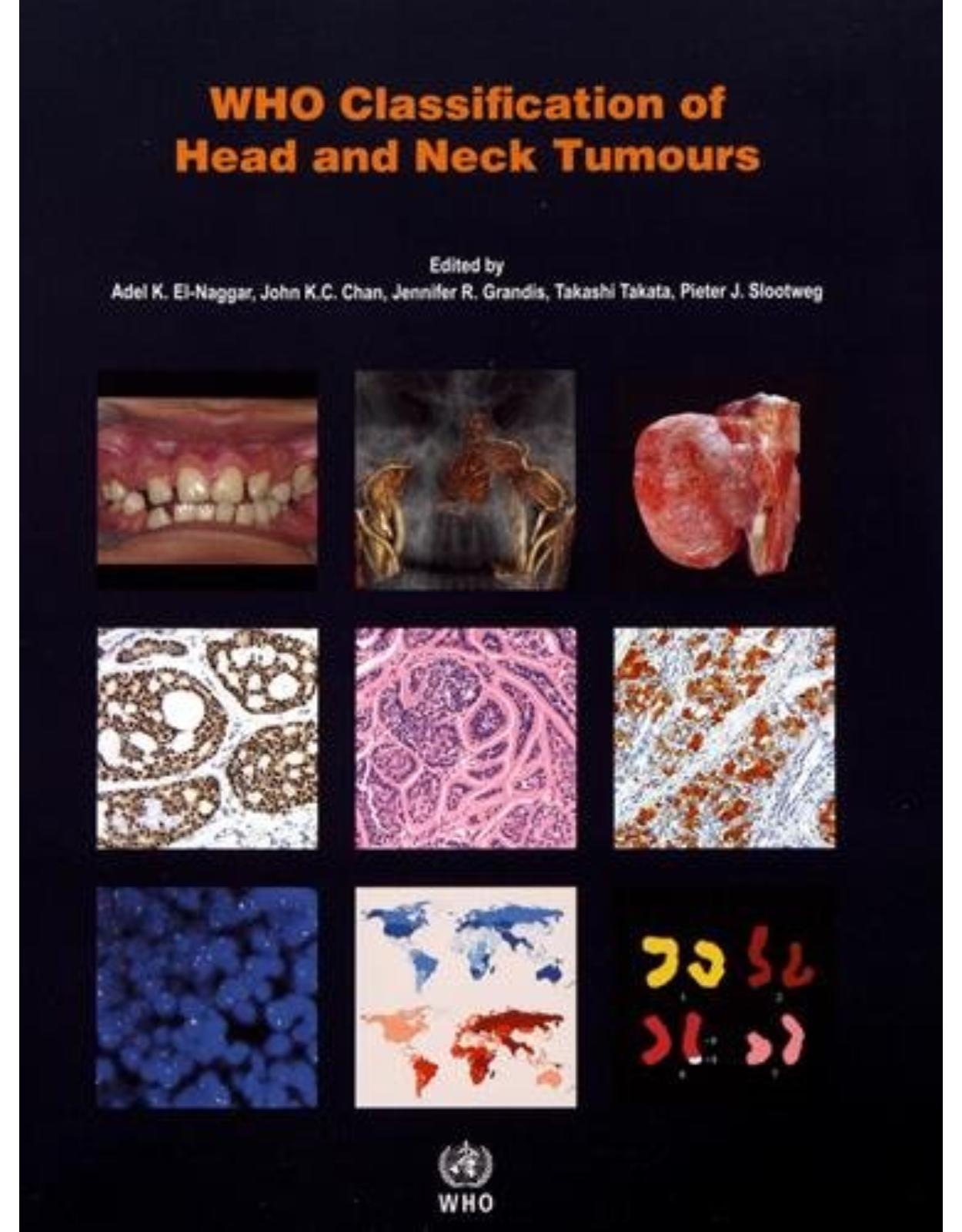 Who Classification of Head and Neck Tumours 