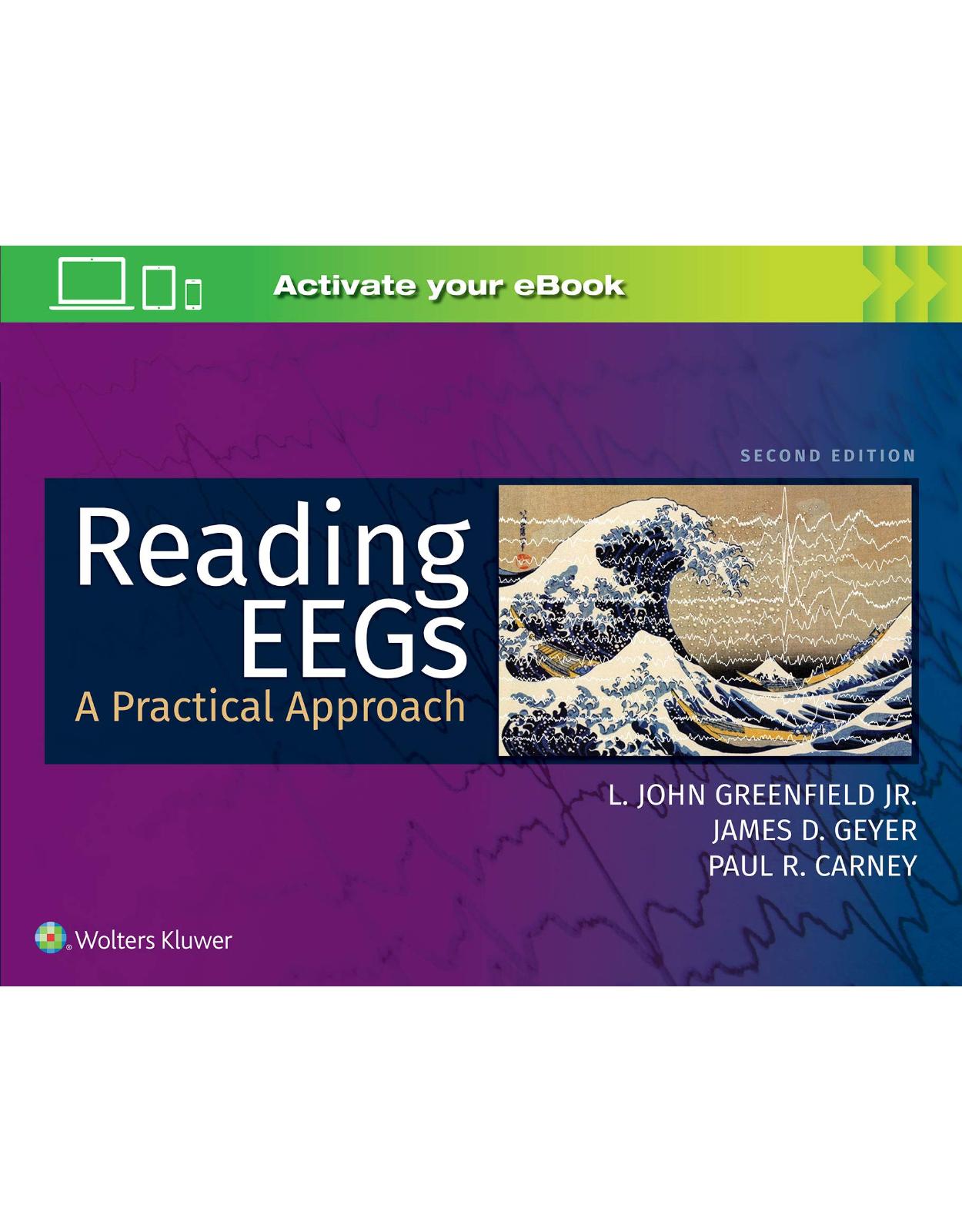 Reading EEGs: A Practical Approach 