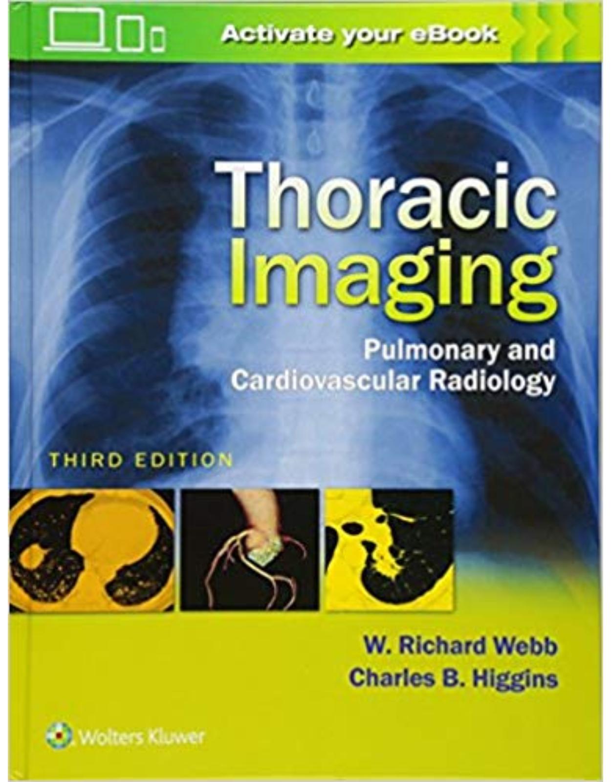 Thoracic Imaging, 3ePULMONARY AND CARDIOVASCULAR RADIOLOGY