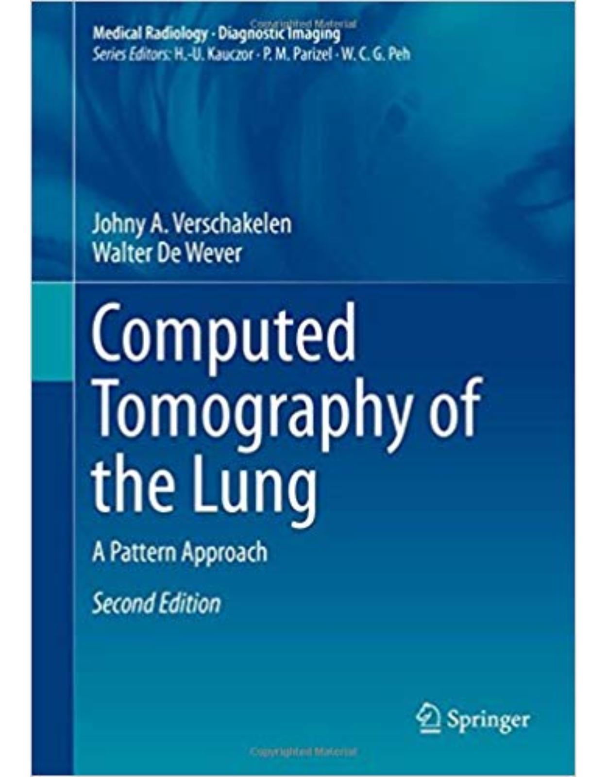 Computed Tomography of the Lung: A Pattern Approach