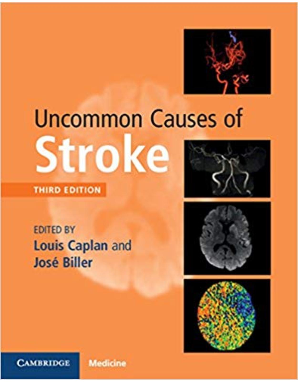 Uncommon Causes of Stroke