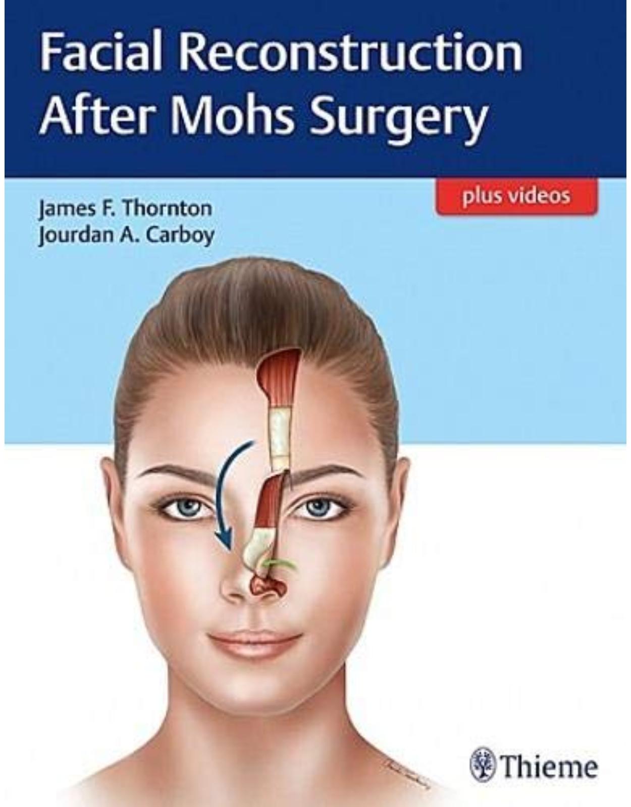 Facial Reconstruction After Mohs Surgery 