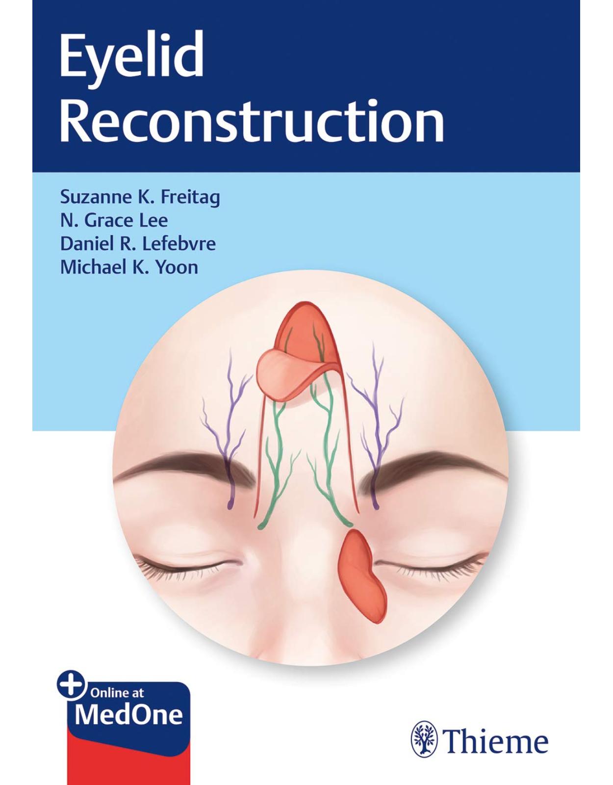 Eyelid Reconstruction