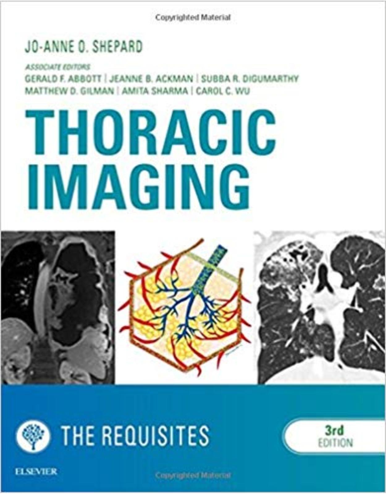 Thoracic Imaging The Requisites, 3e