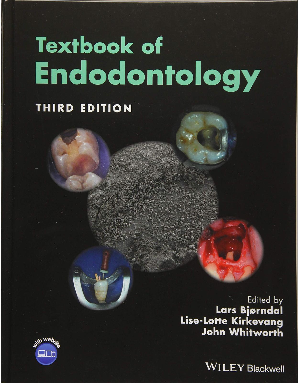 Textbook of Endodontology