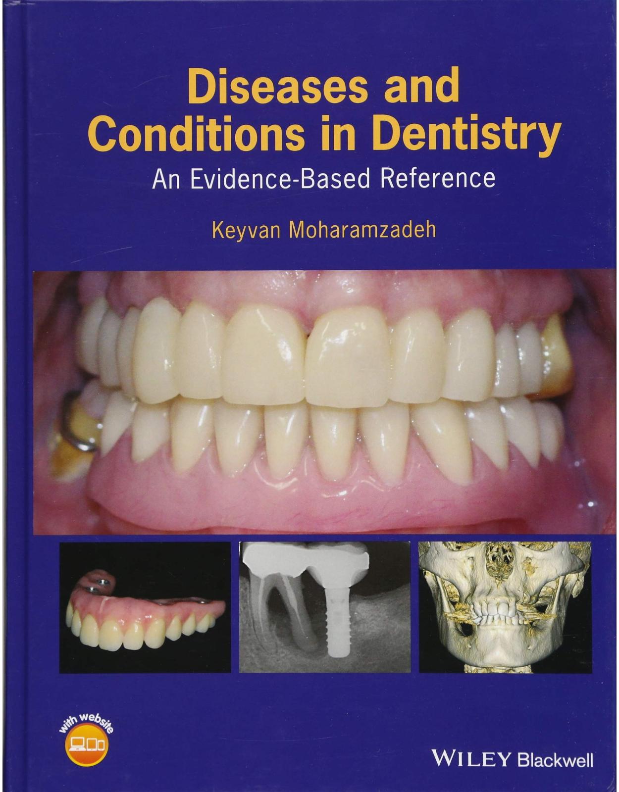 Diseases and Conditions in Dentistry: An Evidence–Based Reference 