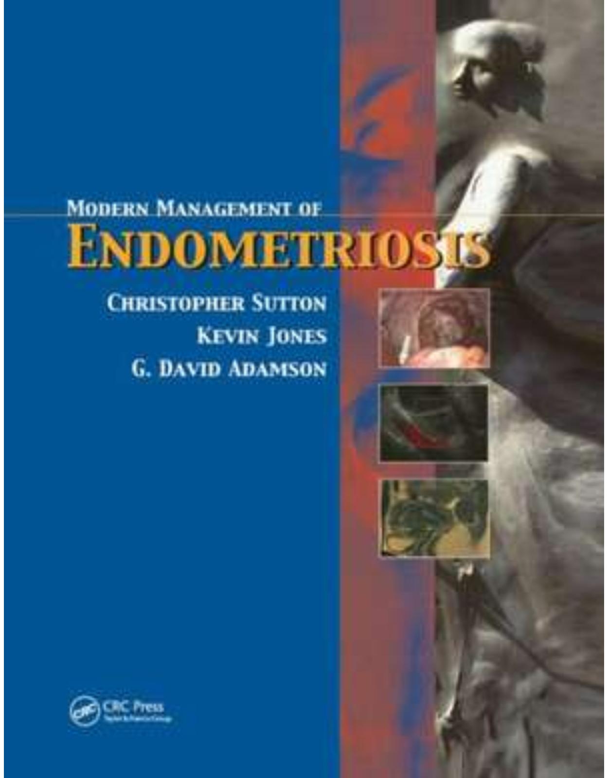 Modern Management of Endometriosis