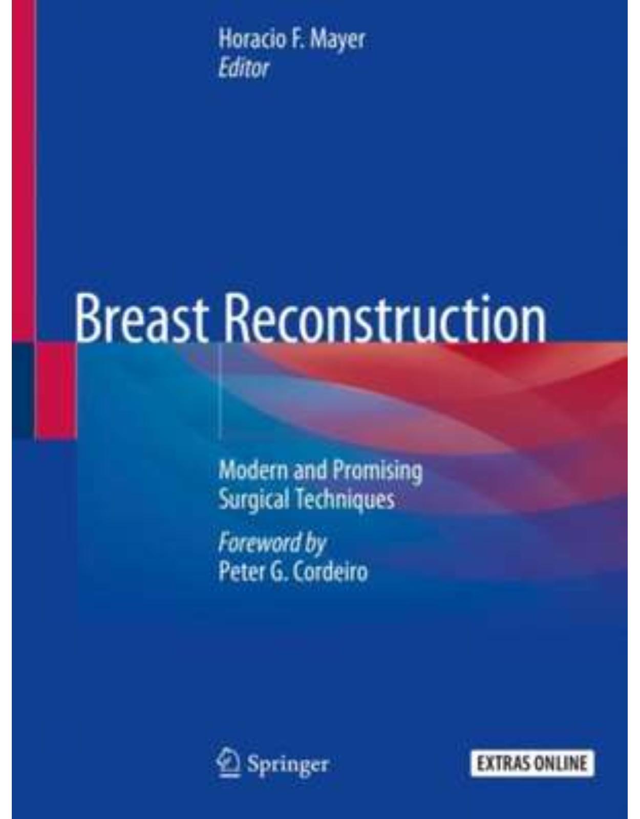 Breast Reconstruction: Modern and Promising Surgical Techniques