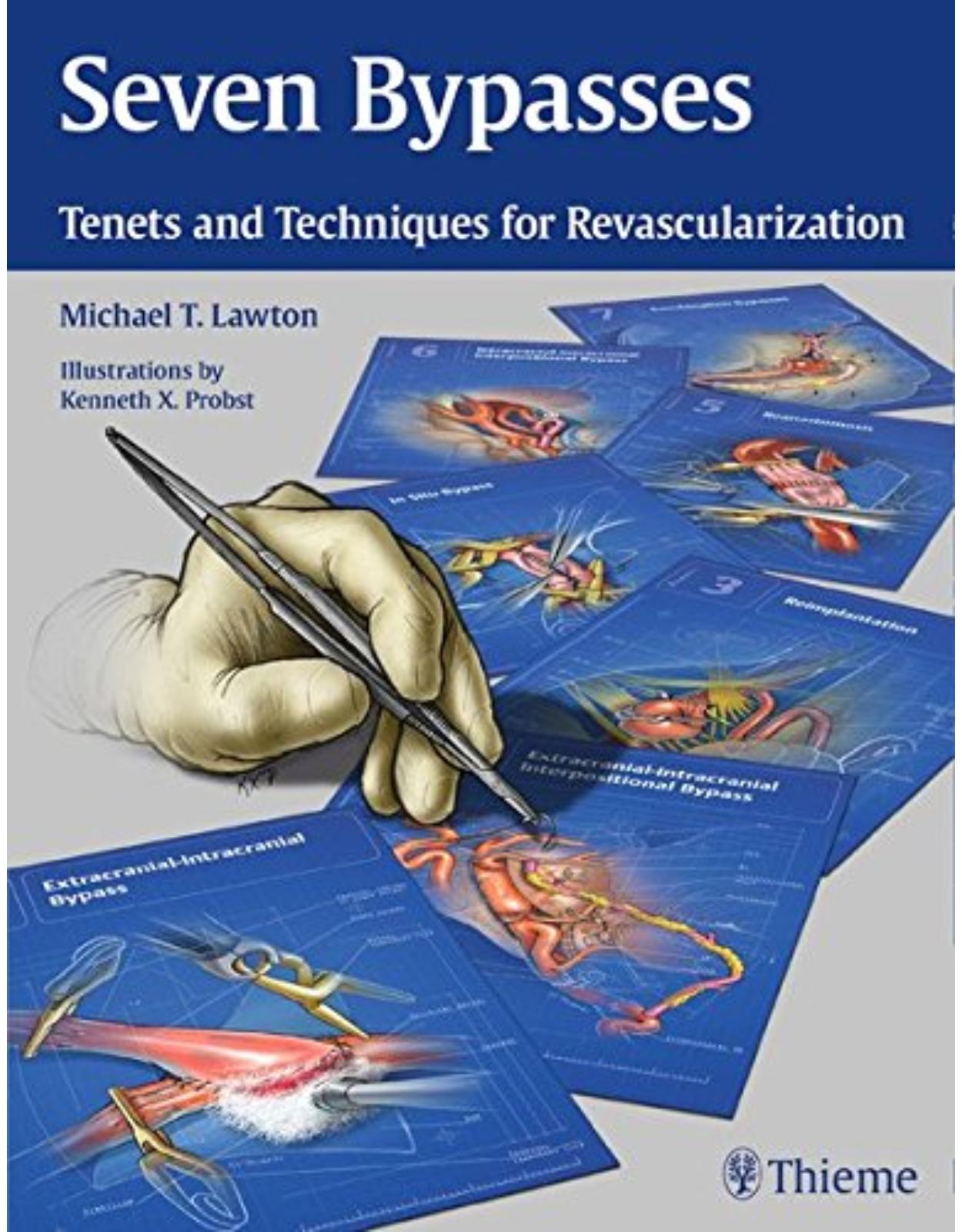 Seven Bypasses: Tenets and Techniques for Revascularization