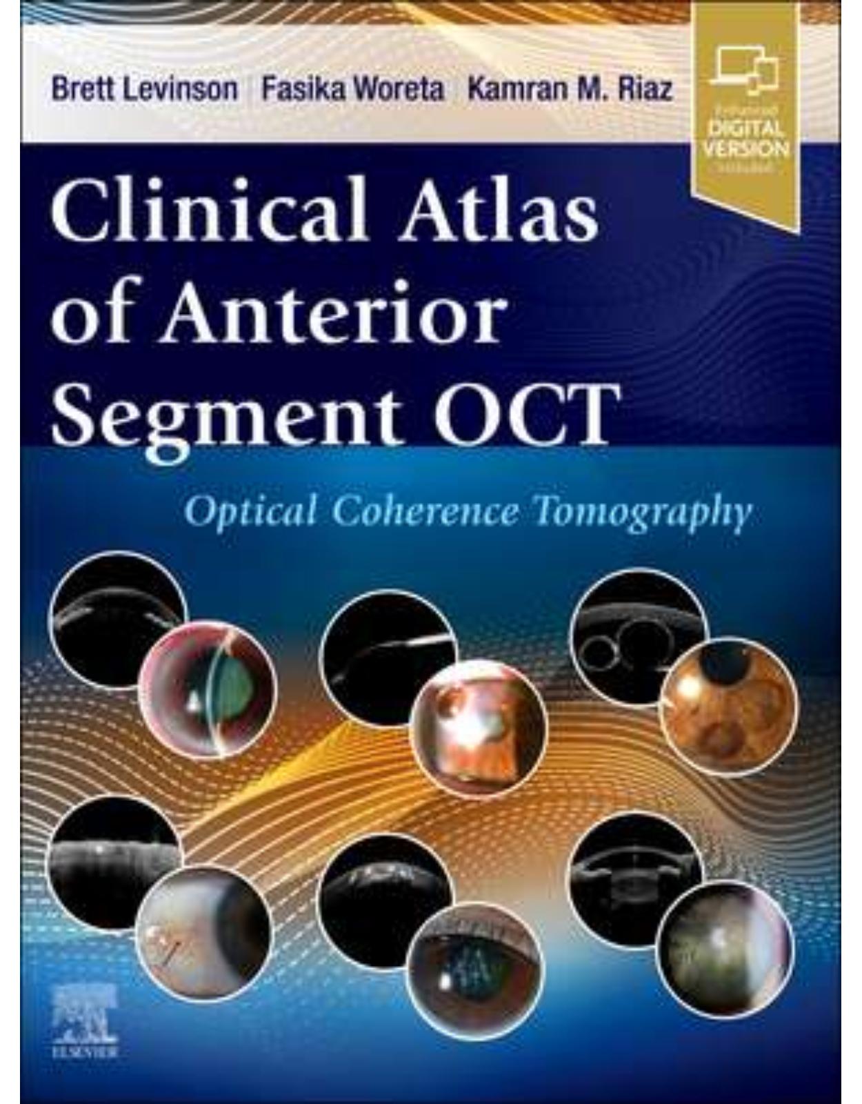 Clinical Atlas of Anterior Segment OCT: Optical Coherence Tomography