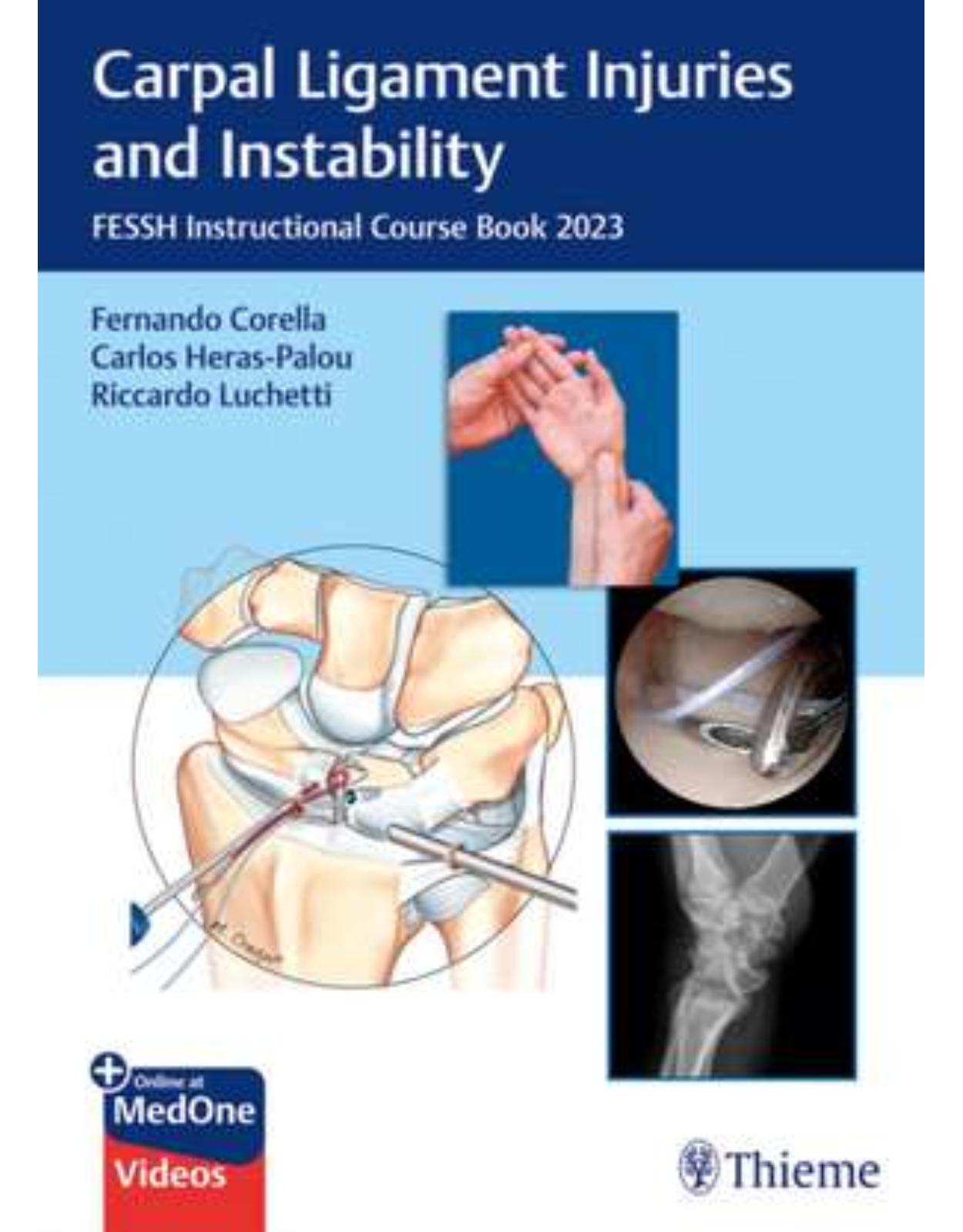 Carpal Ligament Injuries and Instability