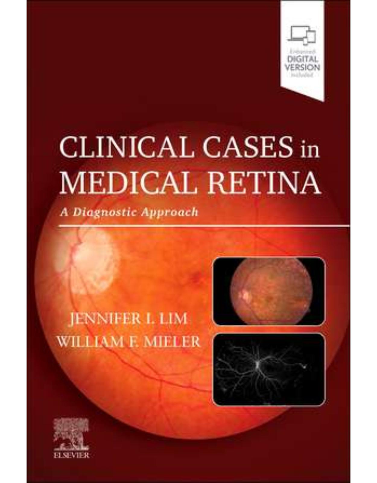 Clinical Cases in Medical Retina: A Diagnostic Approach