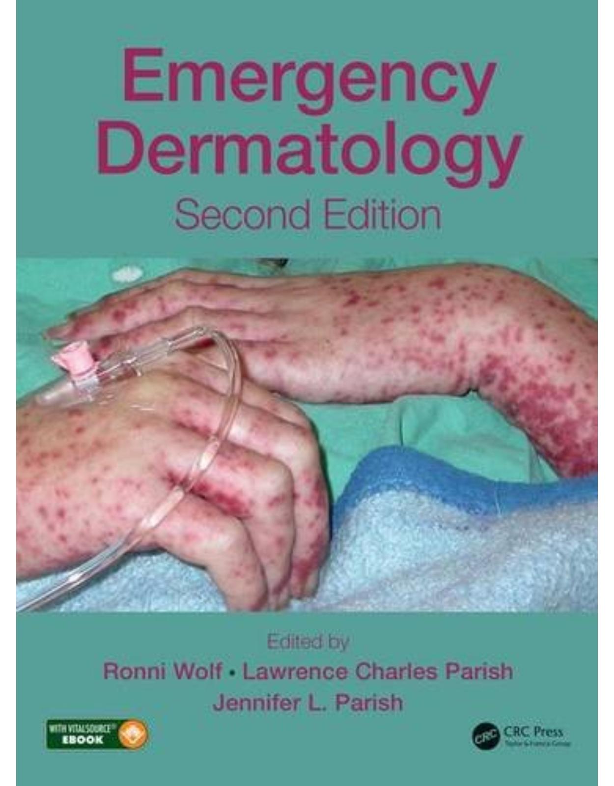 Emergency Dermatology, Second Edition