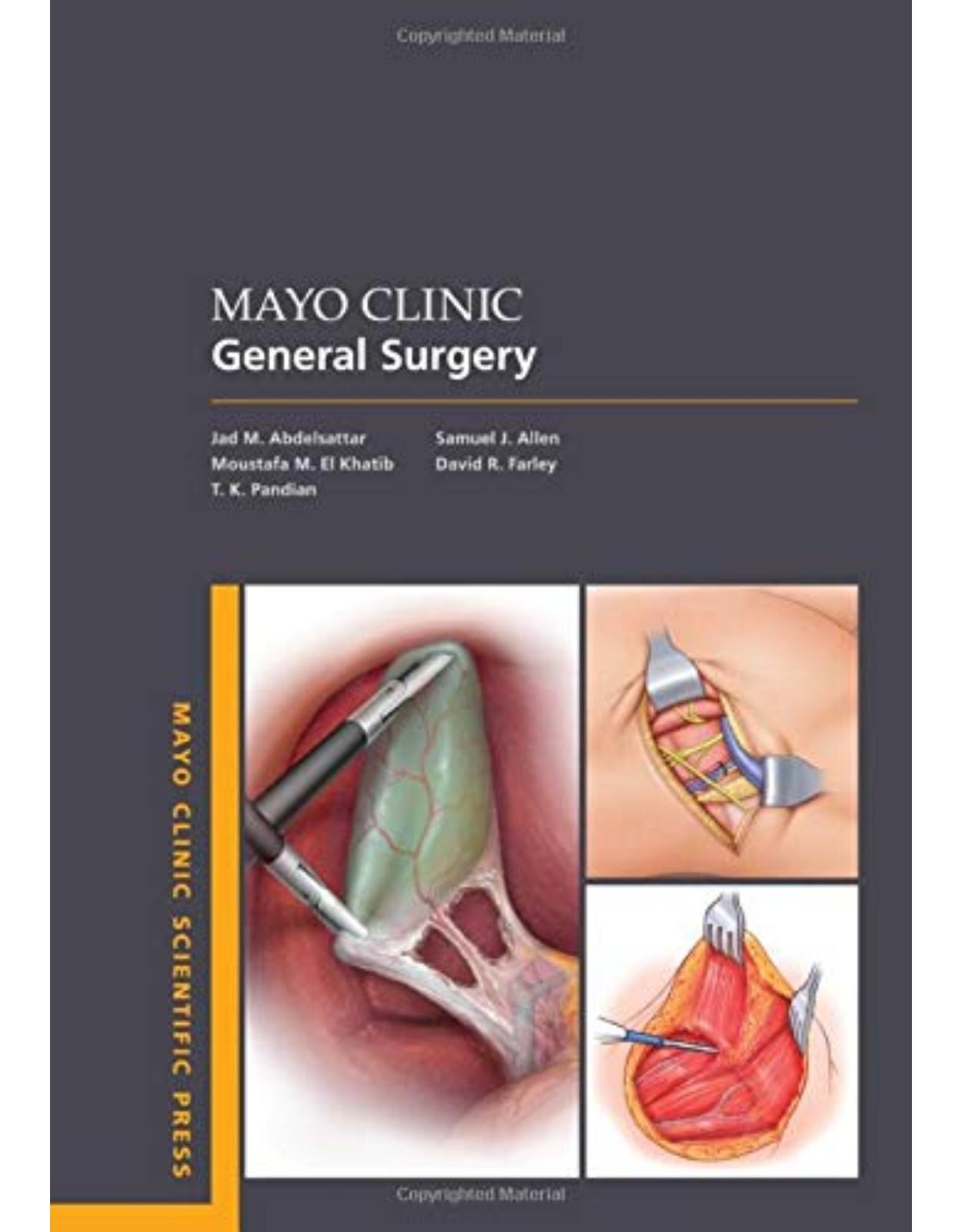 Mayo Clinic General Surgery