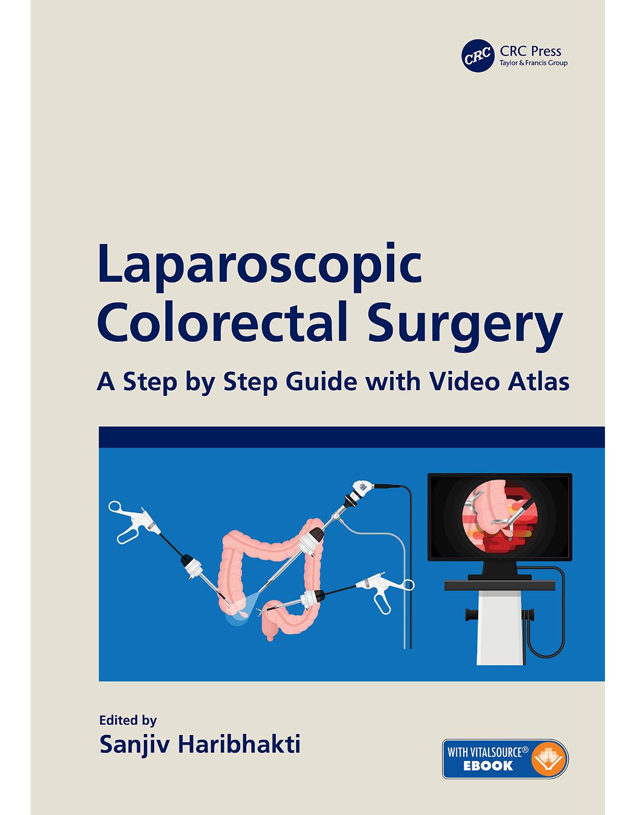Laparoscopic Colorectal Surgery: A Step by Step Guide with Video Atlas