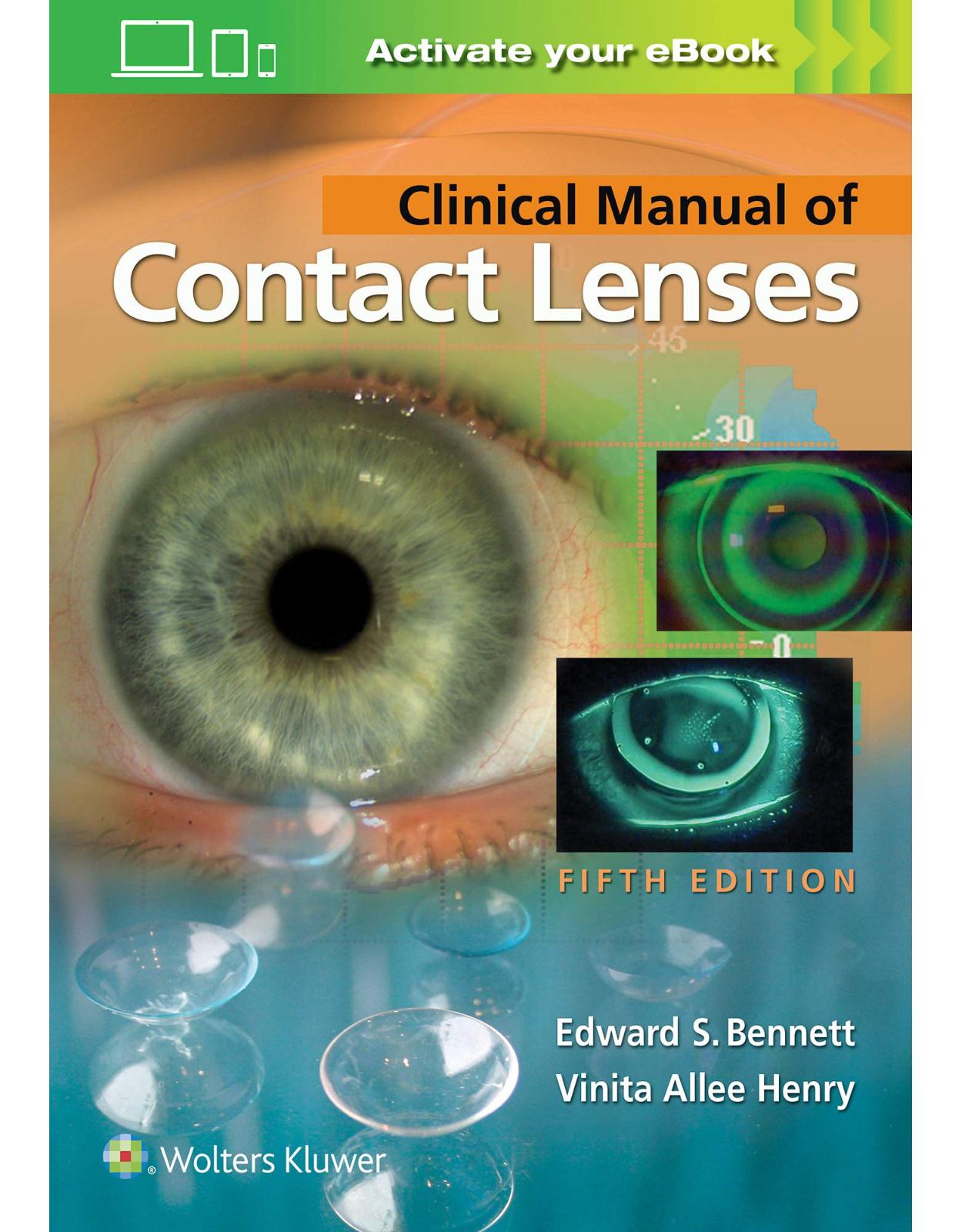 Clinical Manual of Contact Lenses 