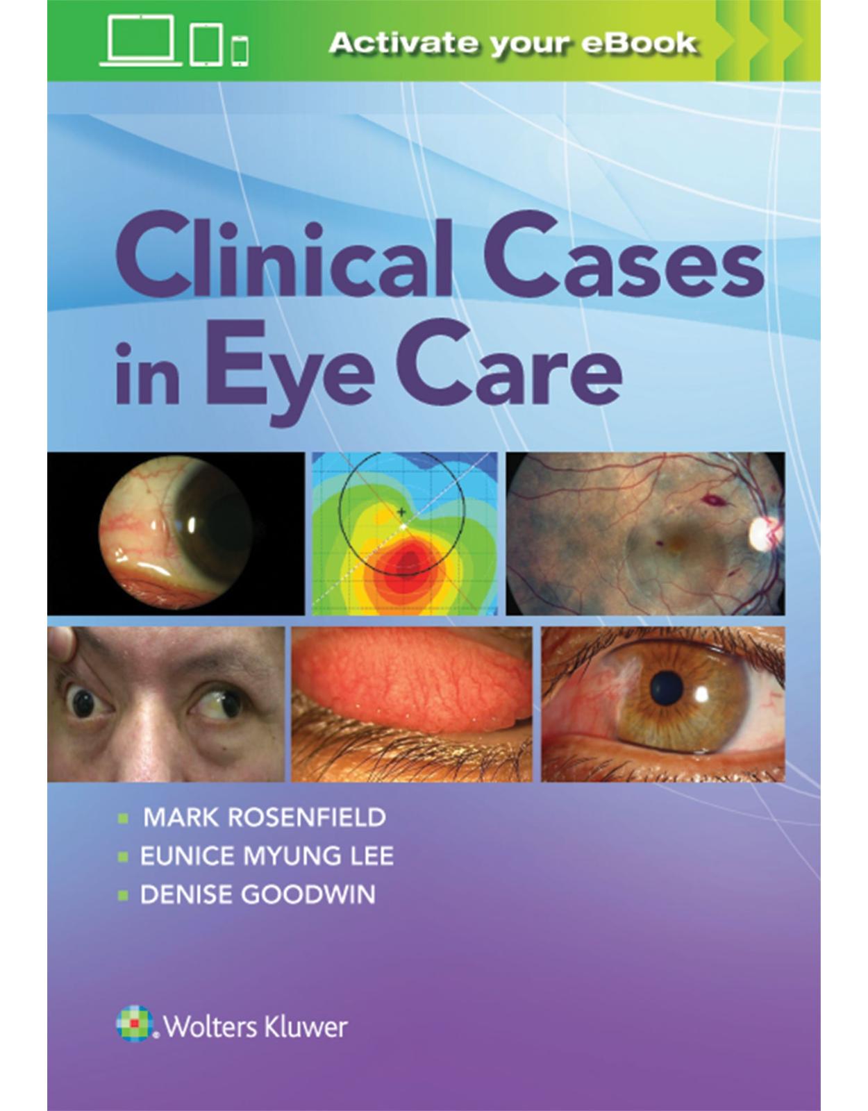 Clinical Cases in Eye Care 
