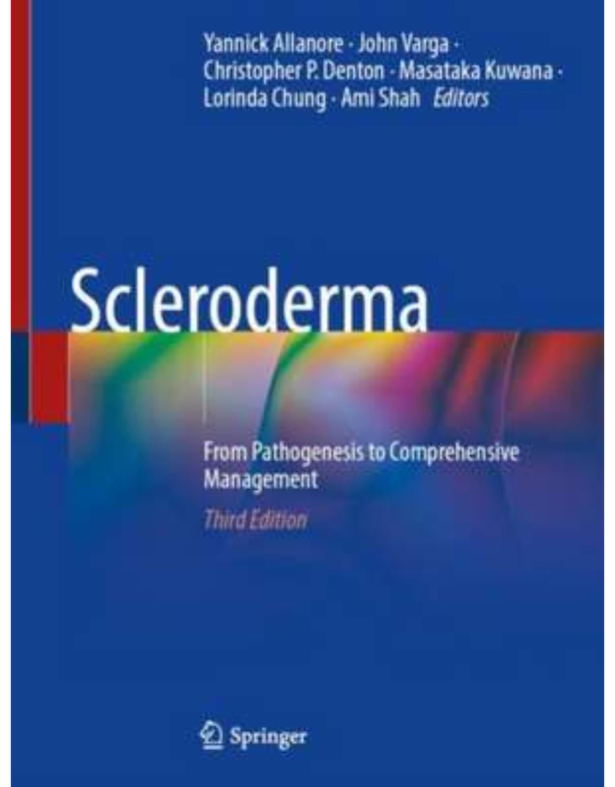 Scleroderma: From Pathogenesis to Comprehensive Management