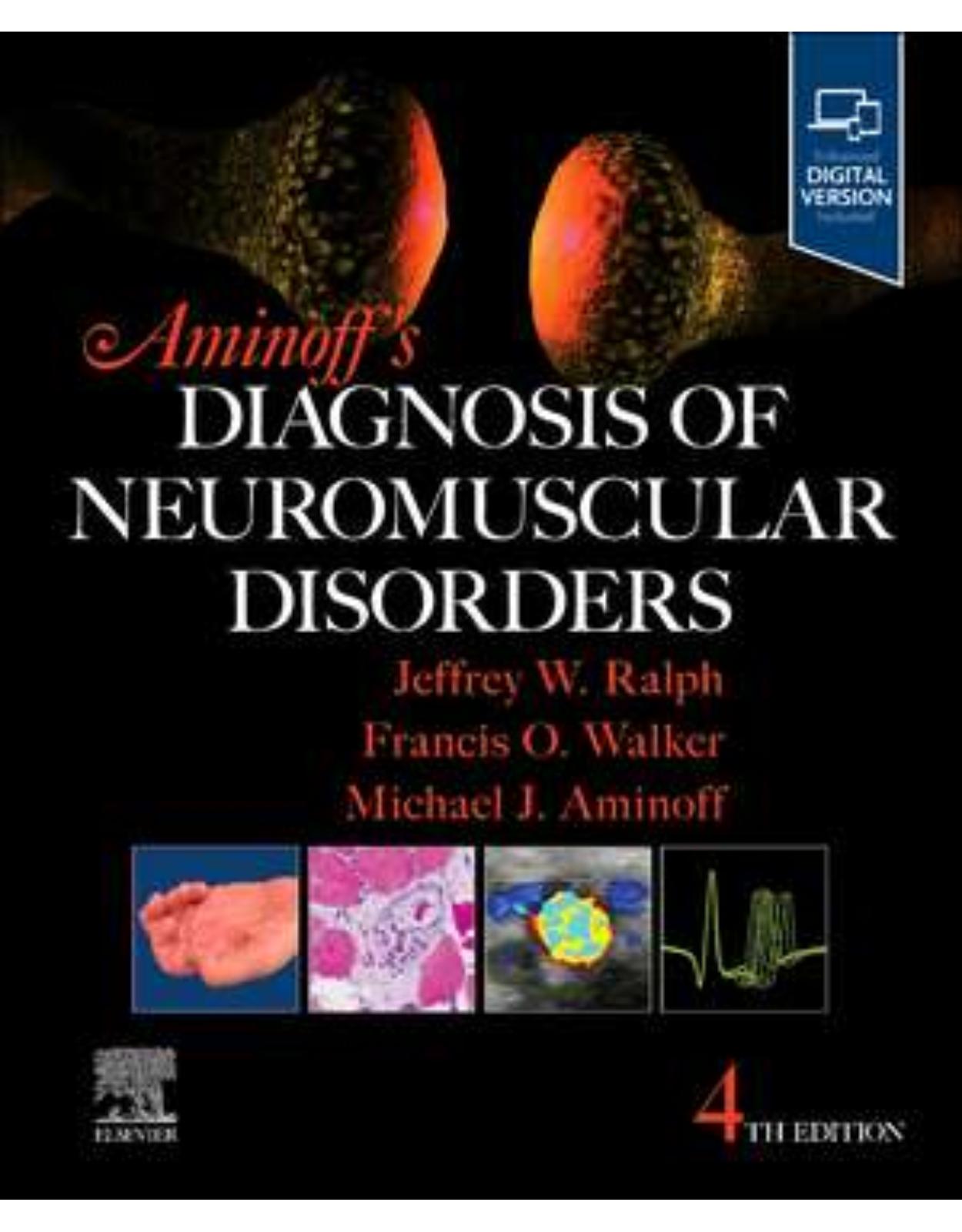 Aminoff's Diagnosis of Neuromuscular Disorders