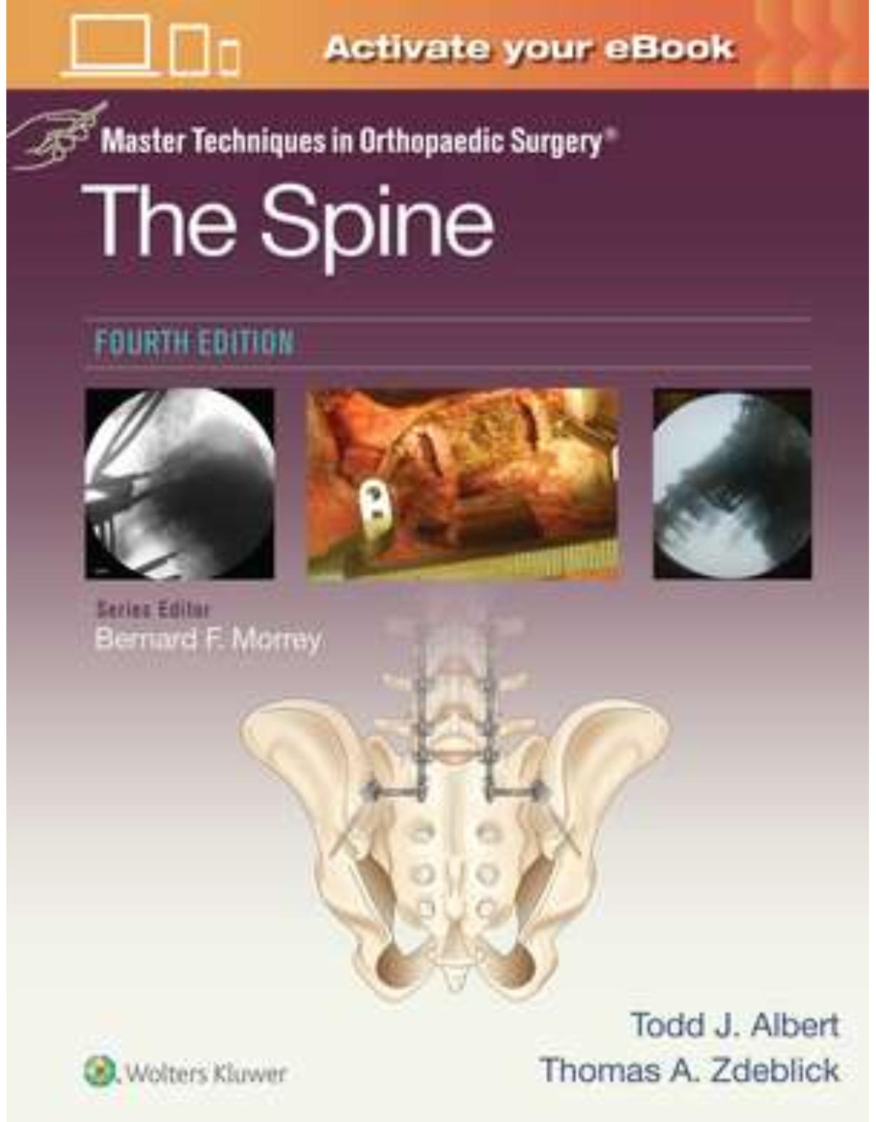 Master Techniques in Orthopaedic Surgery: The Spine