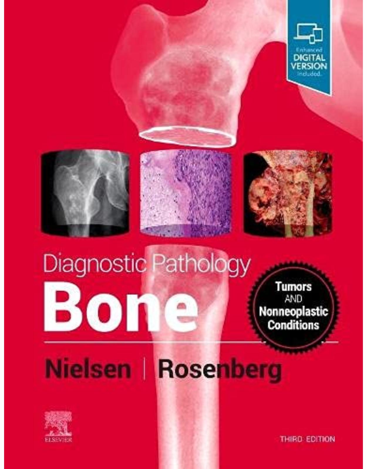 Diagnostic Pathology: Bone