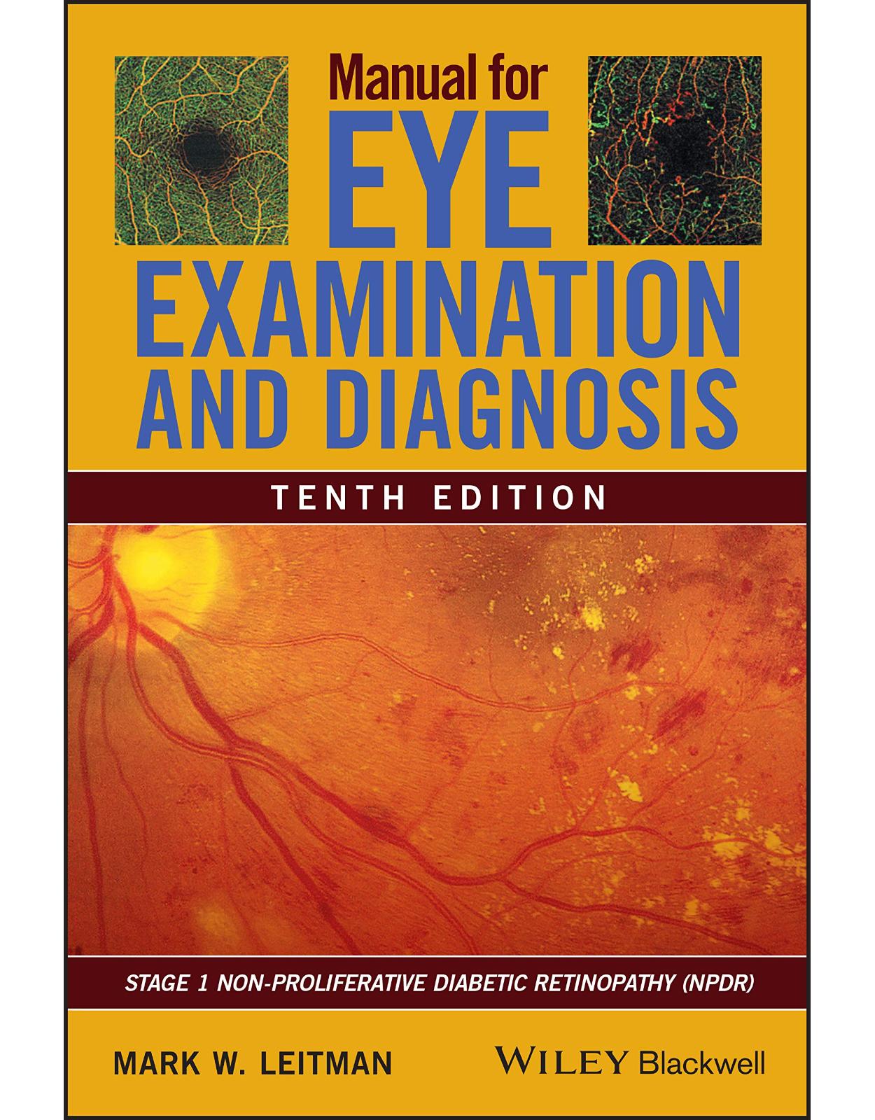 Manual for Eye Examination and Diagnosis