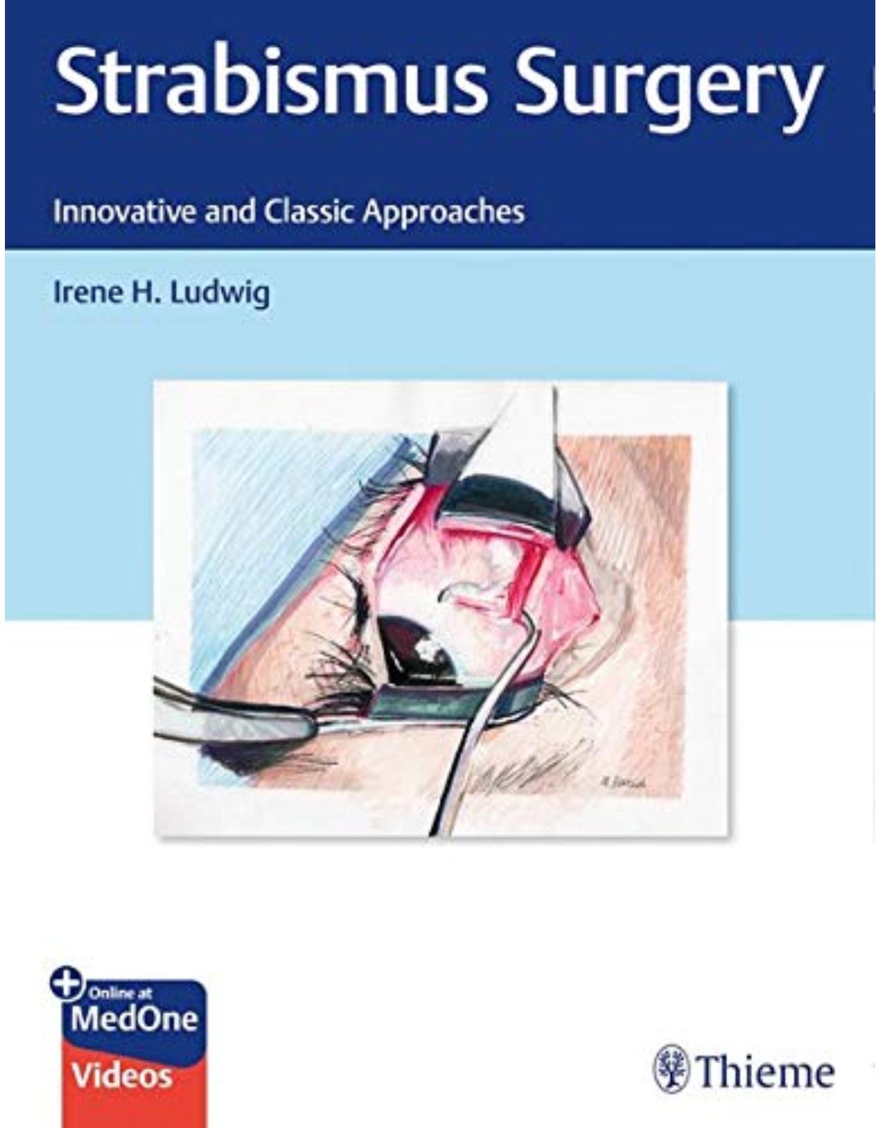 Strabismus Surgery: Innovative and Classic Approaches