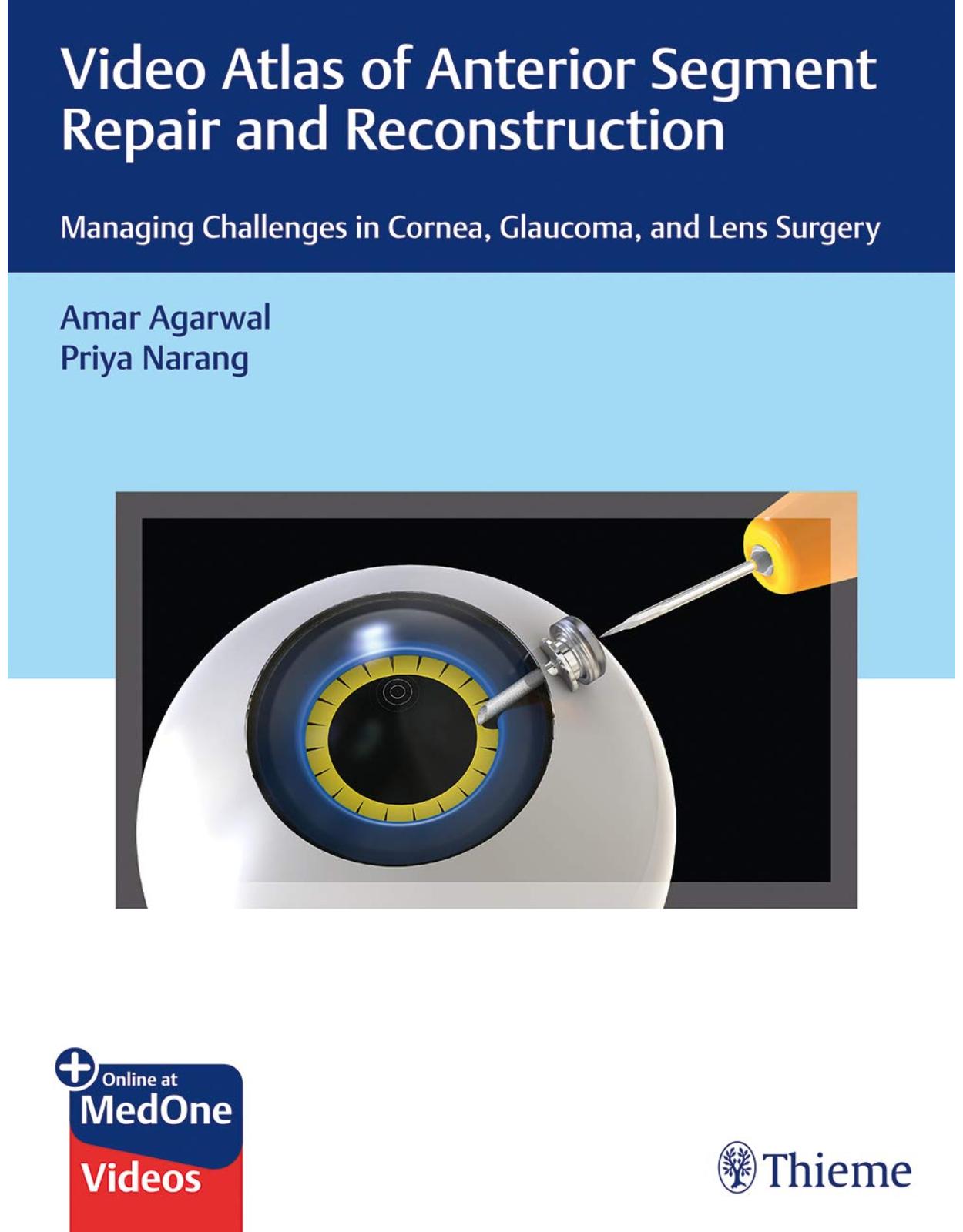 Video Atlas of Anterior Segment Repair and Reconstruction