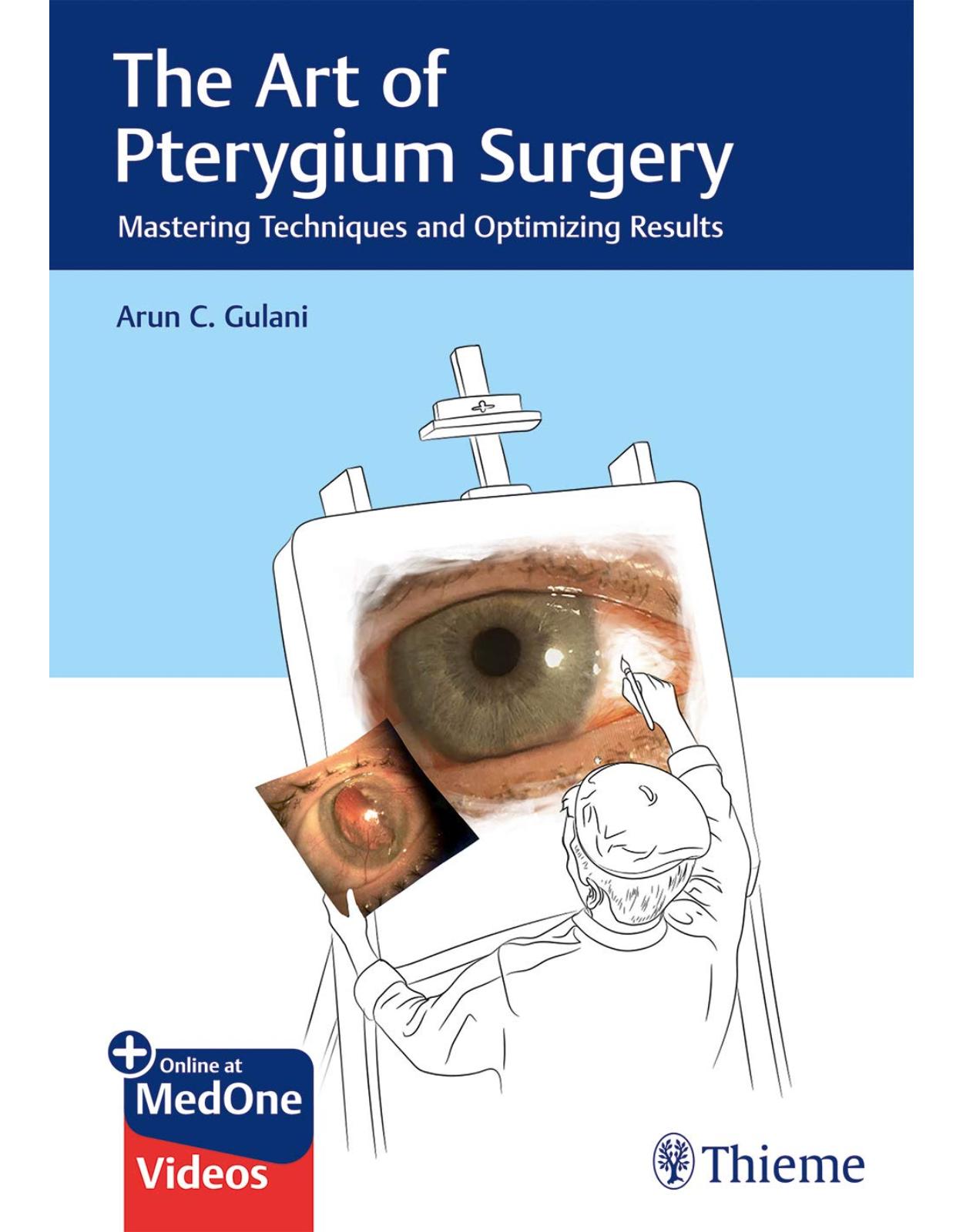 The Art of Pterygium Surgery: Mastering Techniques and Optimizing Results