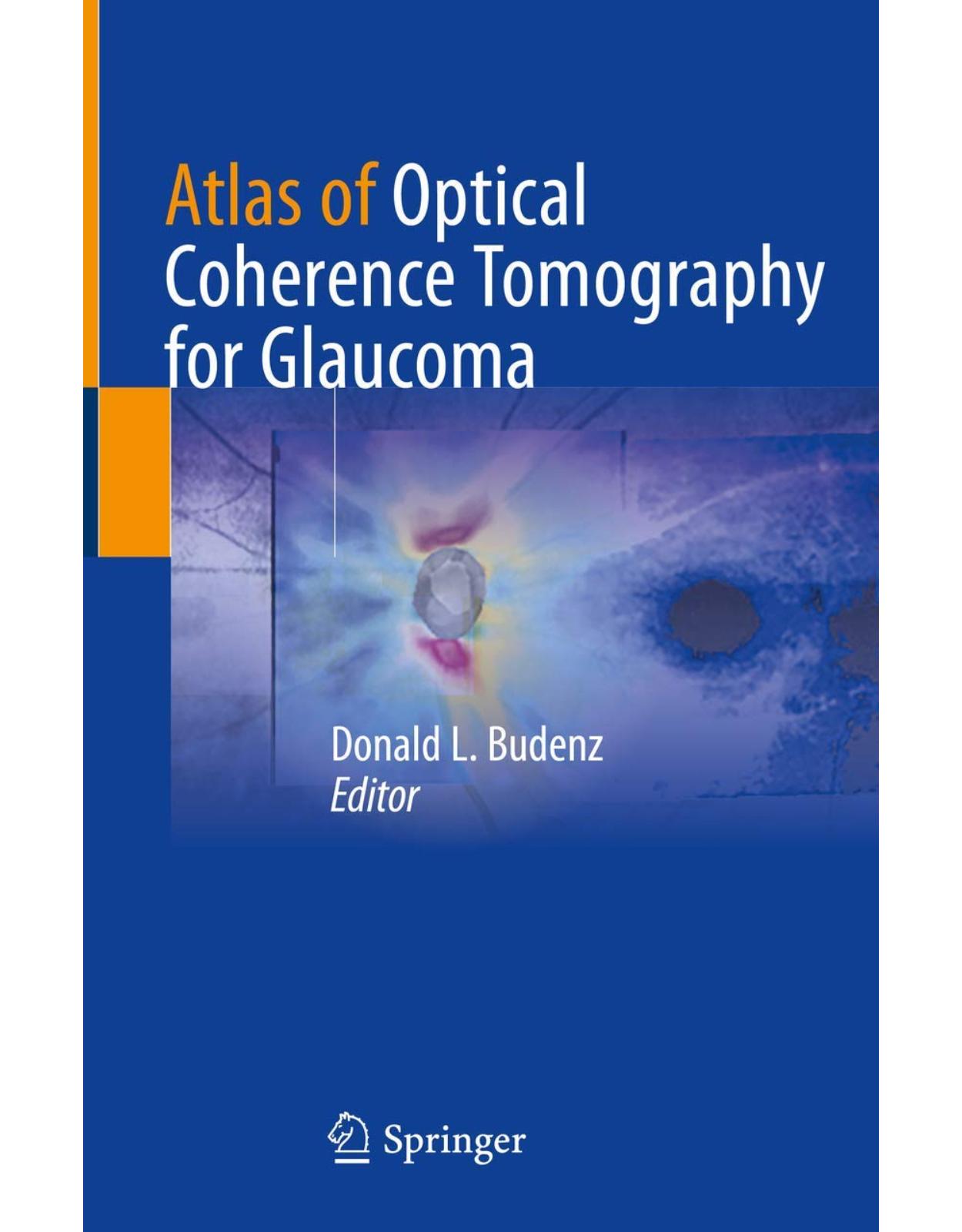 Atlas of Optical Coherence Tomography for Glaucoma