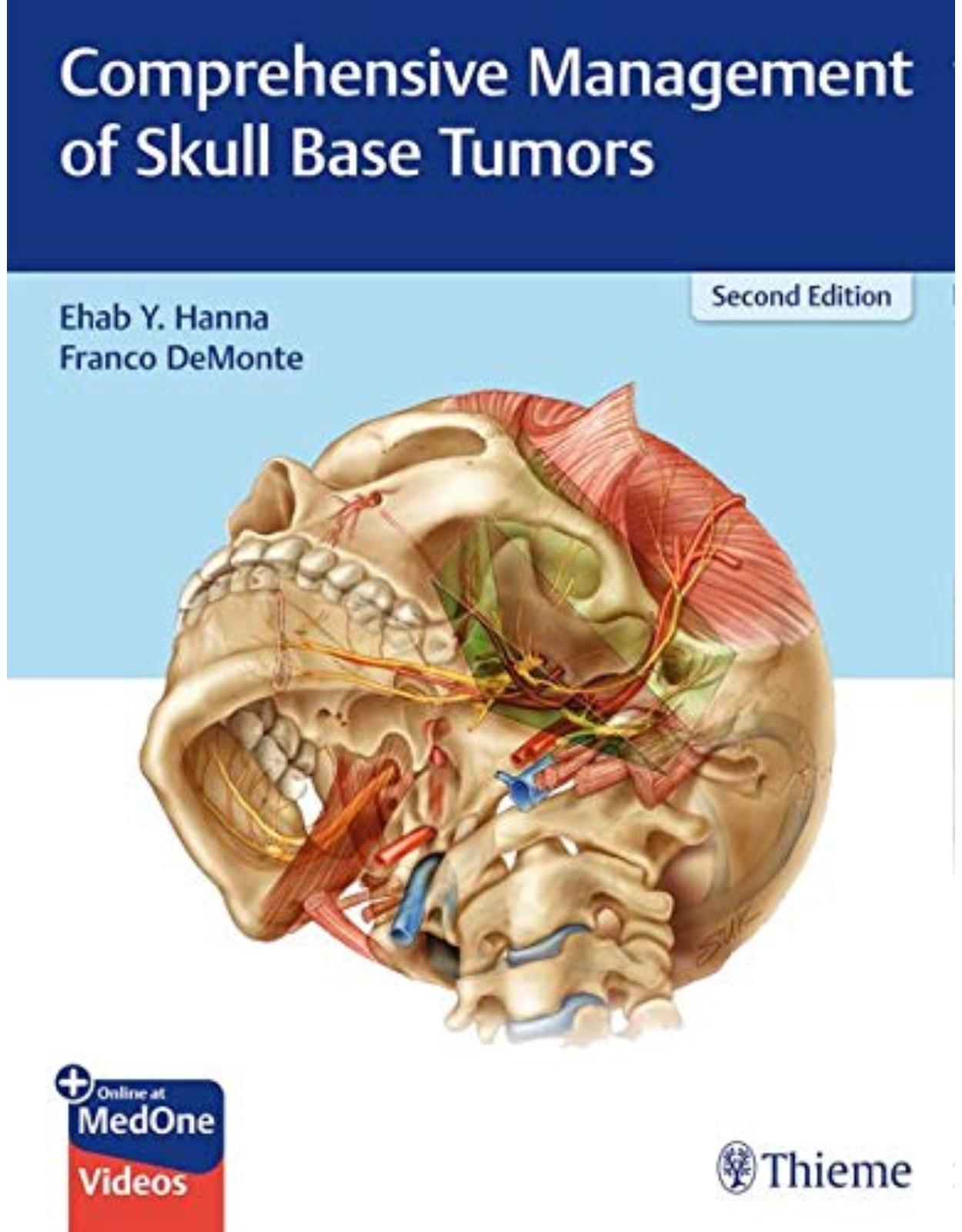 Comprehensive Management of Skull Base Tumors