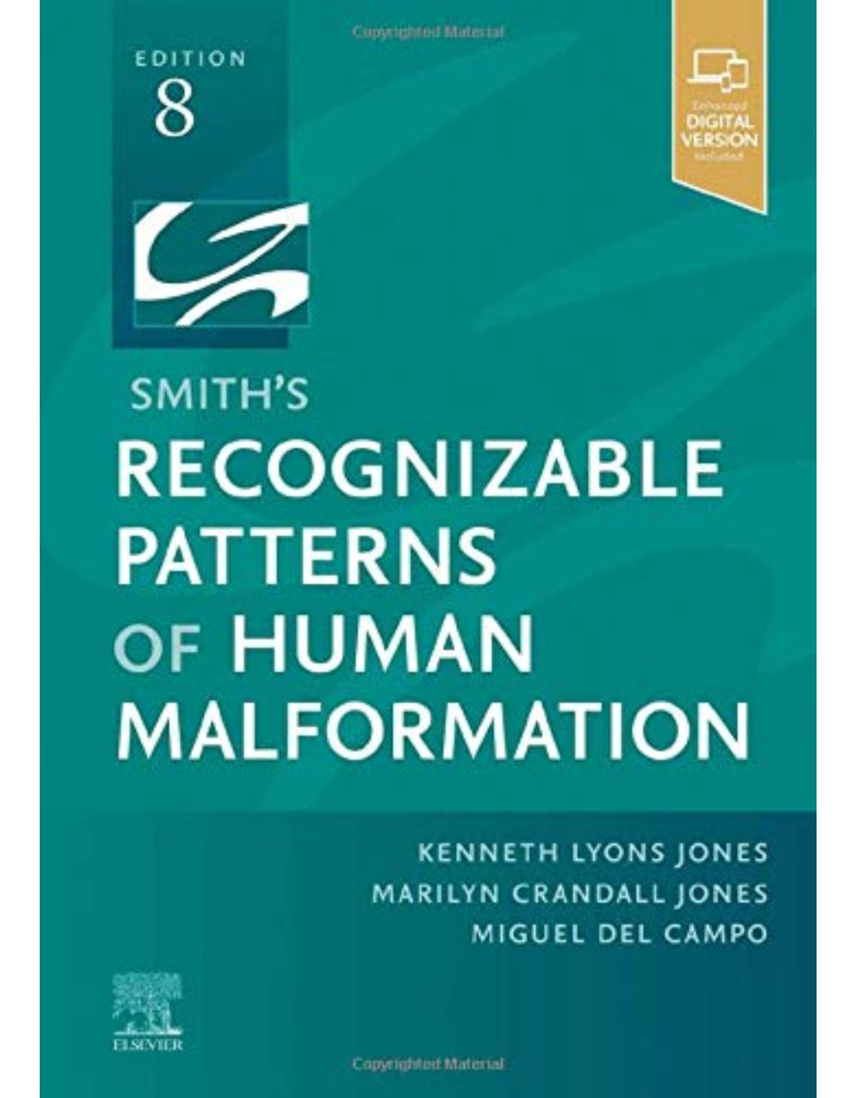 Smith's Recognizable Patterns of Human Malformation: Expert Consult - Online and Print