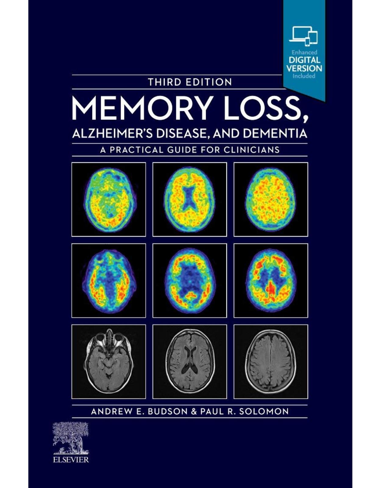 Memory Loss, Alzheimer's Disease and Dementia: A Practical Guide for Clinicians 