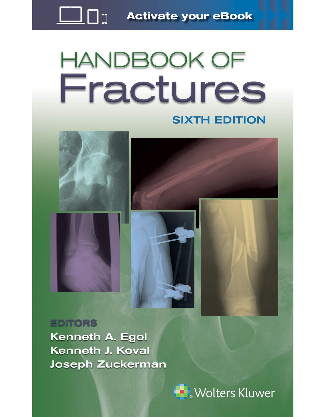 Handbook of Fractures 