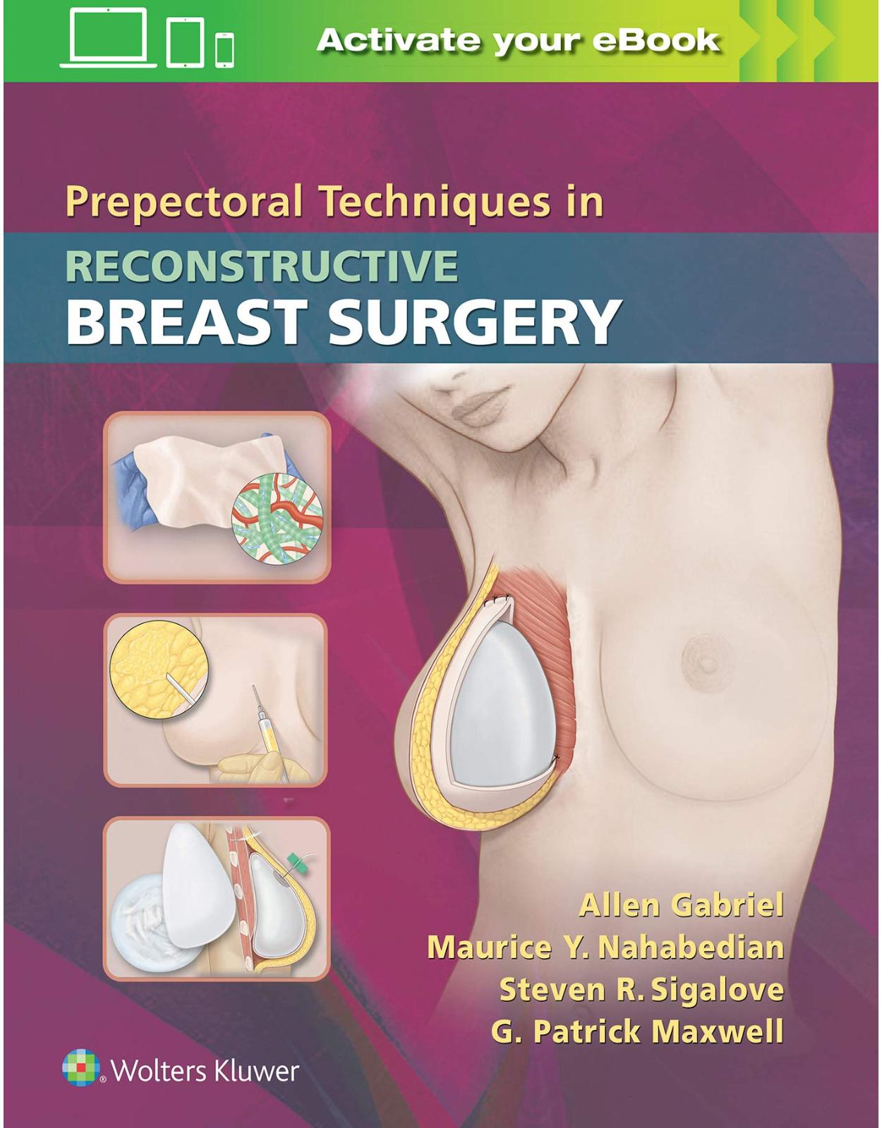 Prepectoral Techniques in Reconstructive Breast Surgery
