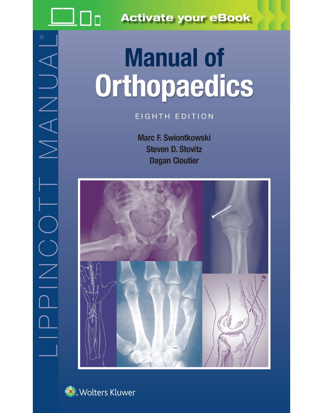 Manual of Orthopaedics 