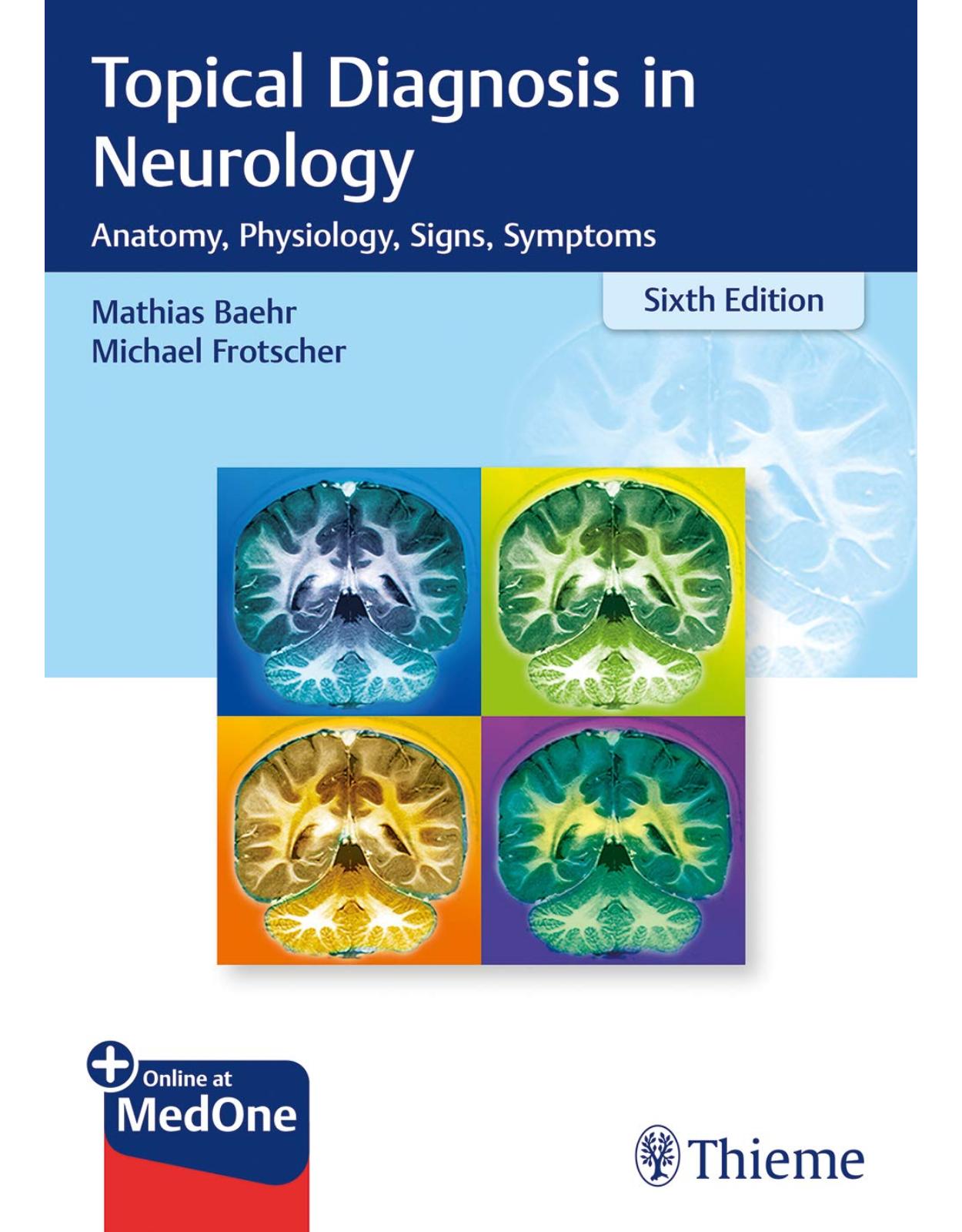 Topical Diagnosis in Neurology: Anatomy, Physiology, Signs, Symptoms 