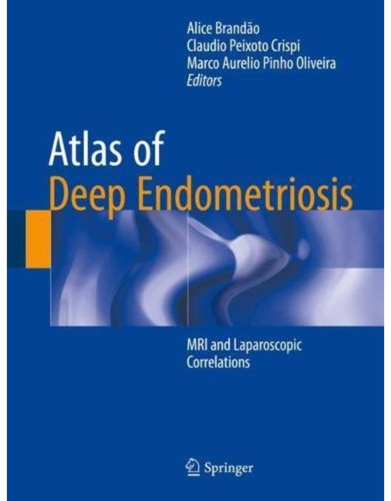 Atlas of Deep Endometriosis: MRI and Laparoscopic Correlations