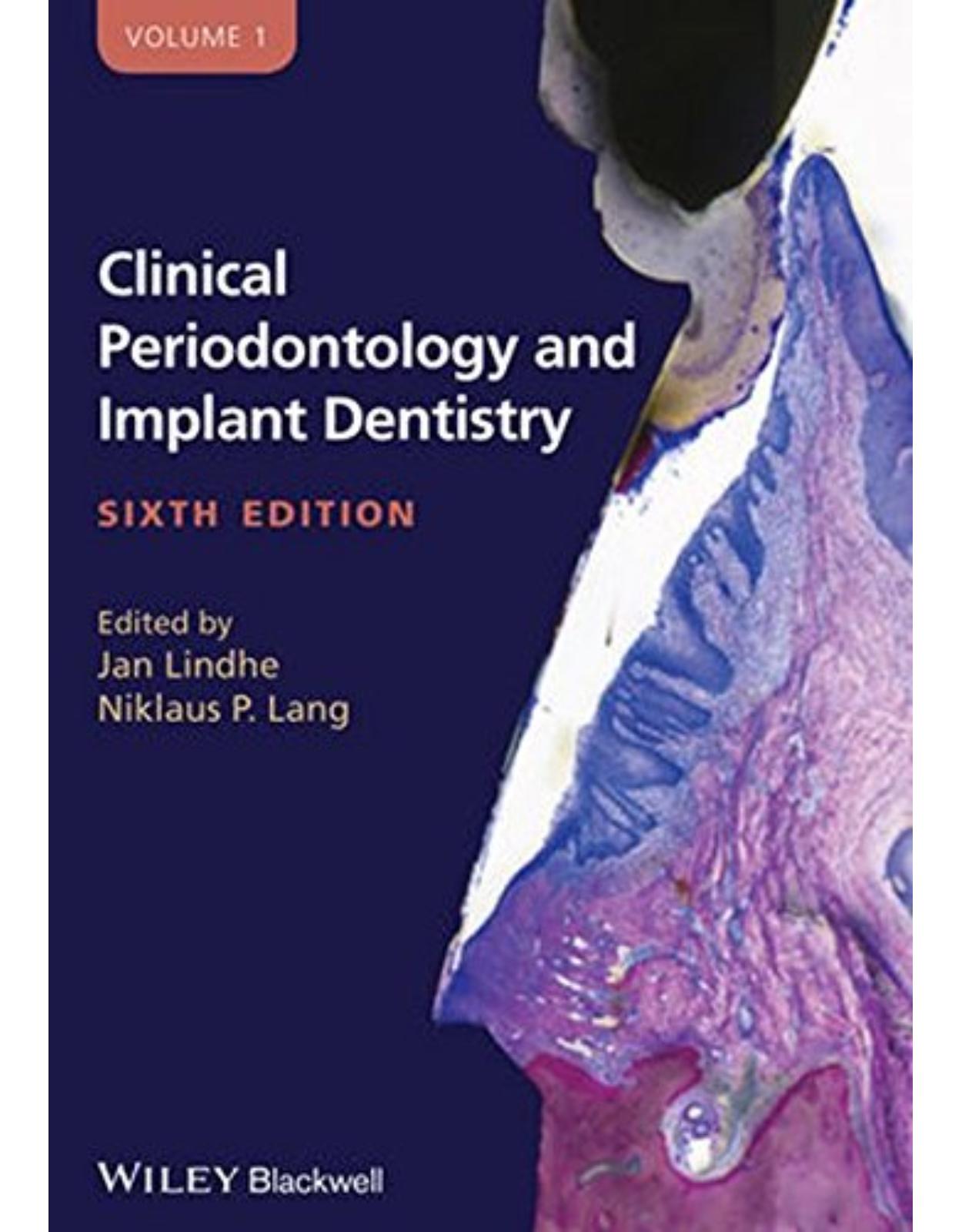 Clinical Periodontology and Implant Dentistry, 2 Volume Set