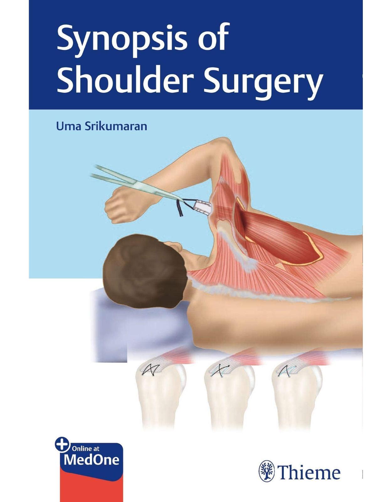 Synopsis of Shoulder Surgery 