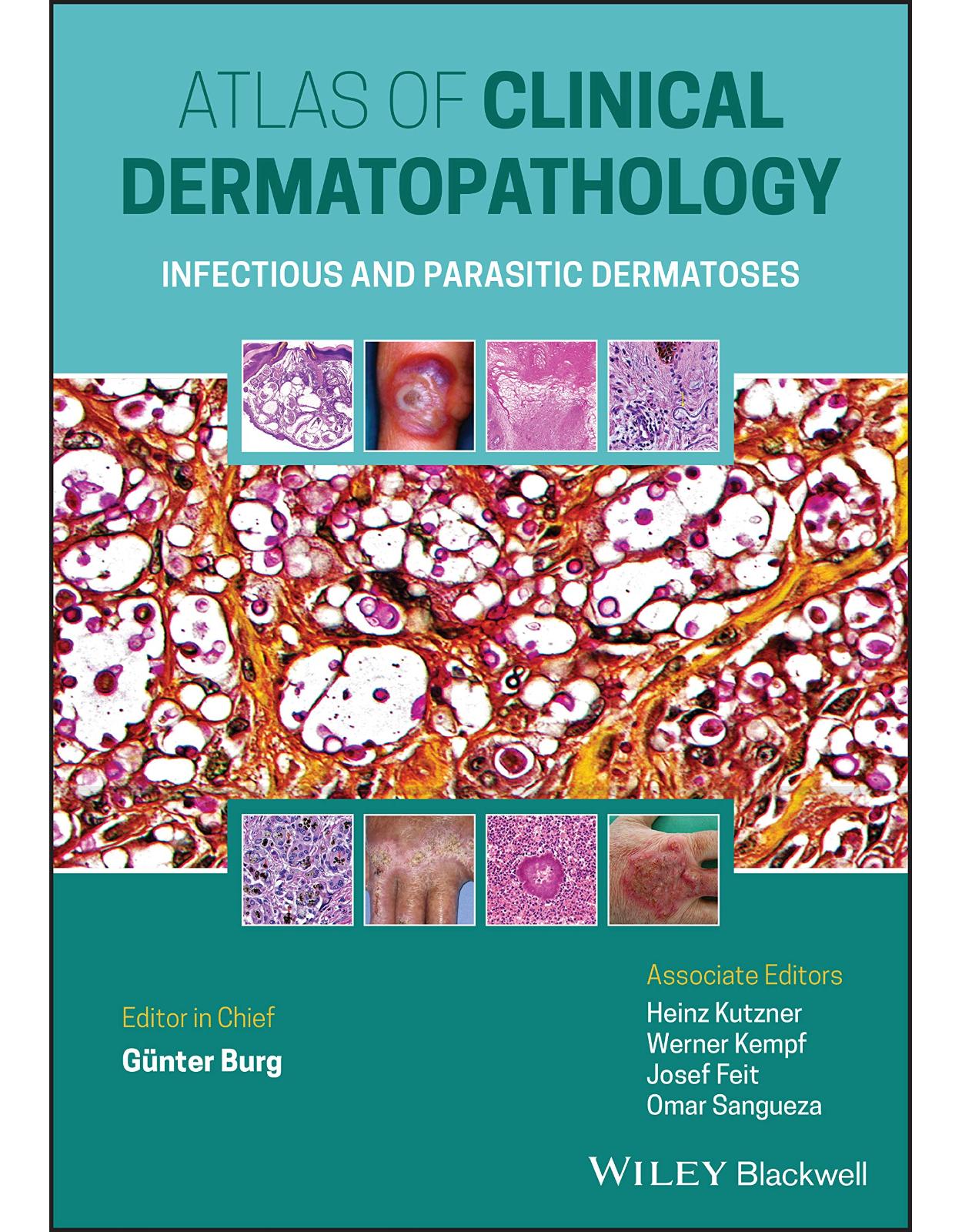 Atlas of Clinical Dermatopathology: Infectious and Parasitic Dermatoses