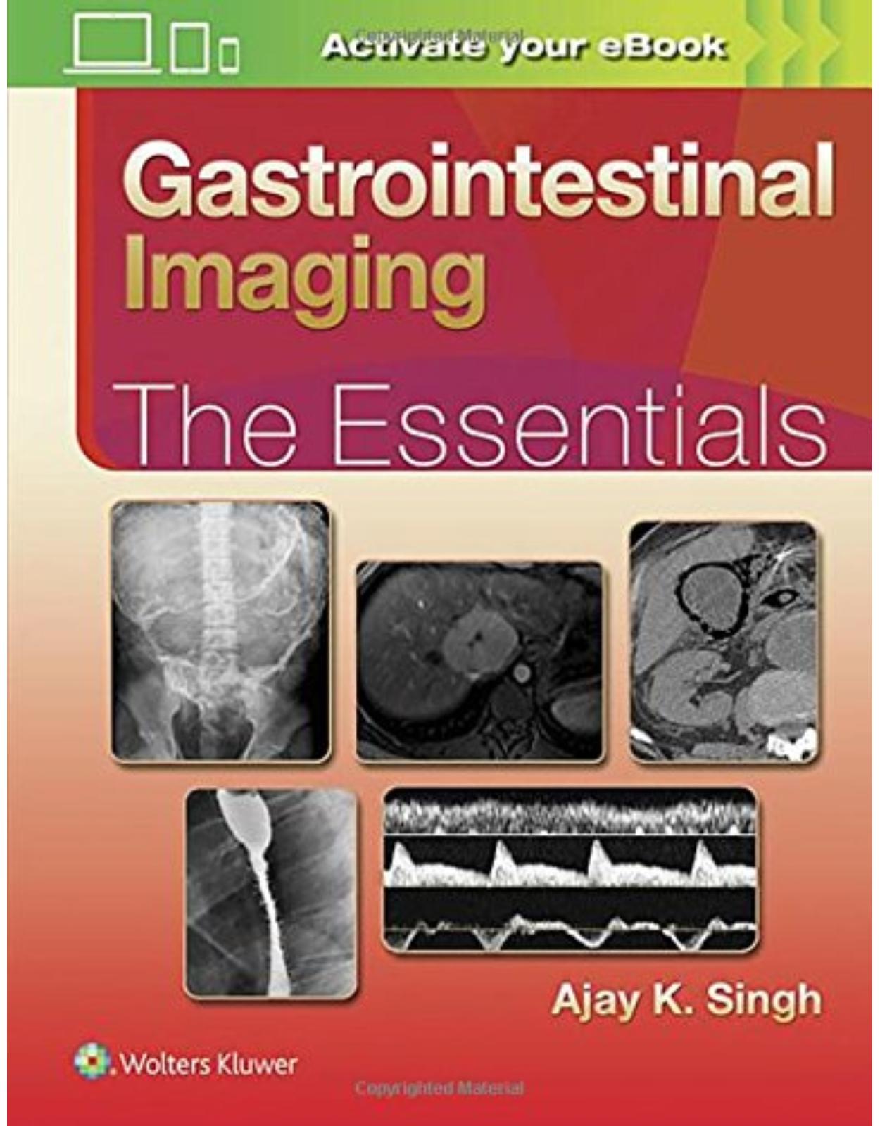 Gastrointestinal Imaging: The Essentials (Essentials Series) 